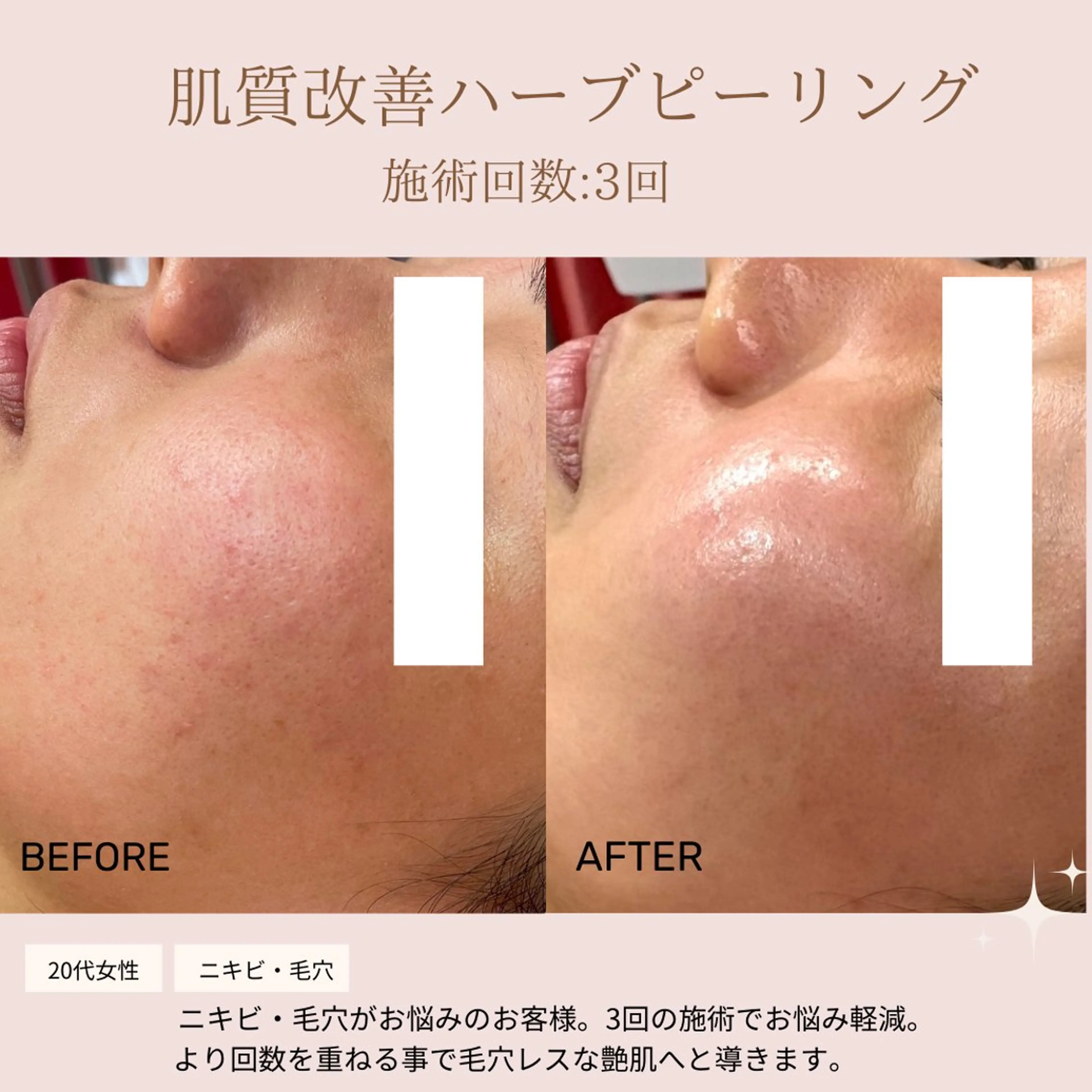 肌質改善専門サロン Bellmi/心斎橋のエステ・リラクイメージ