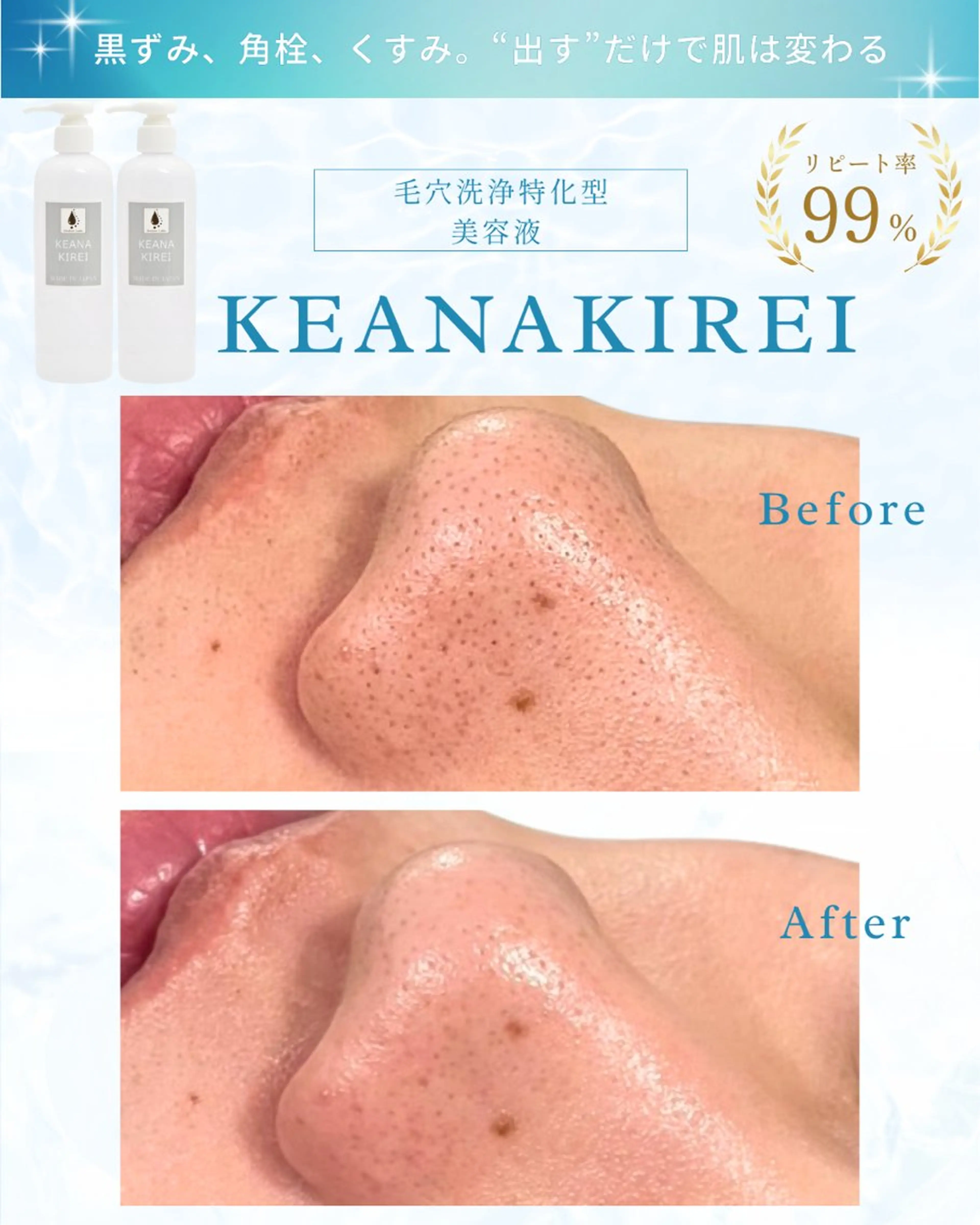 エステ LiAm《美肌管理/ 小顔/脂肪ケア》のその他イメージ