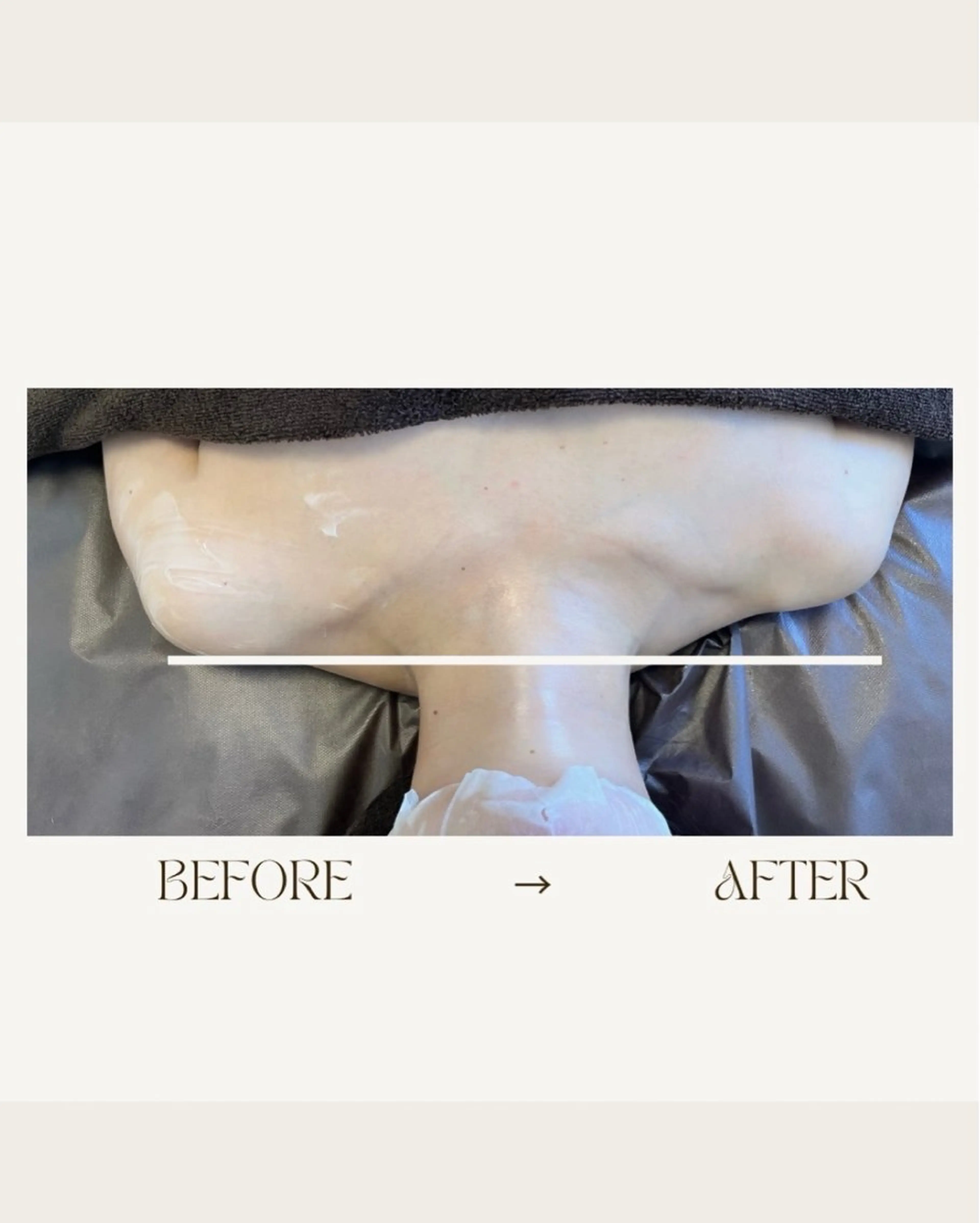 エステ 1st｜フェイシャル エステ専門店のエステ・リラクイメージ