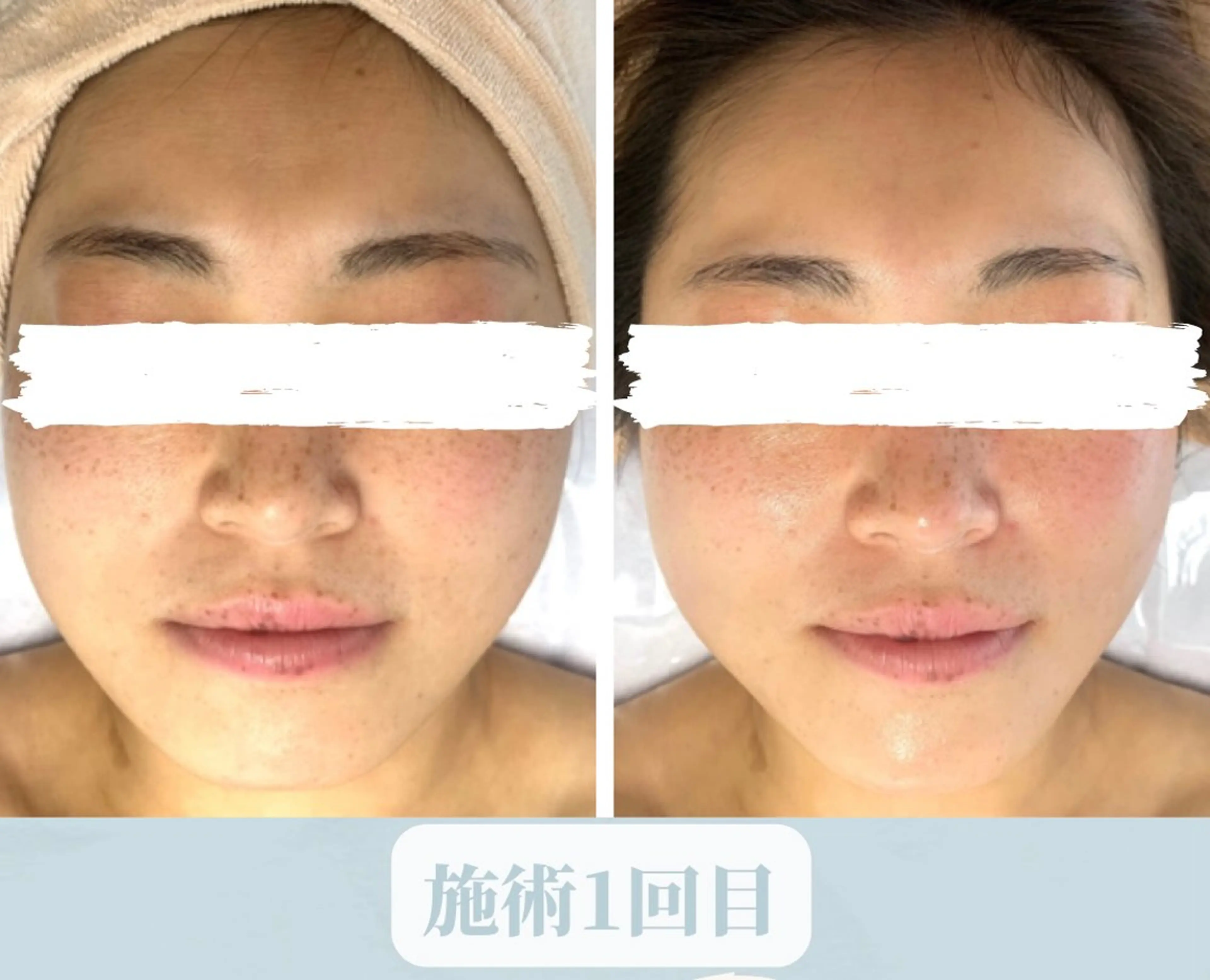 小顔&デコルテ Spa　“koti”のエステ・リラクイメージ