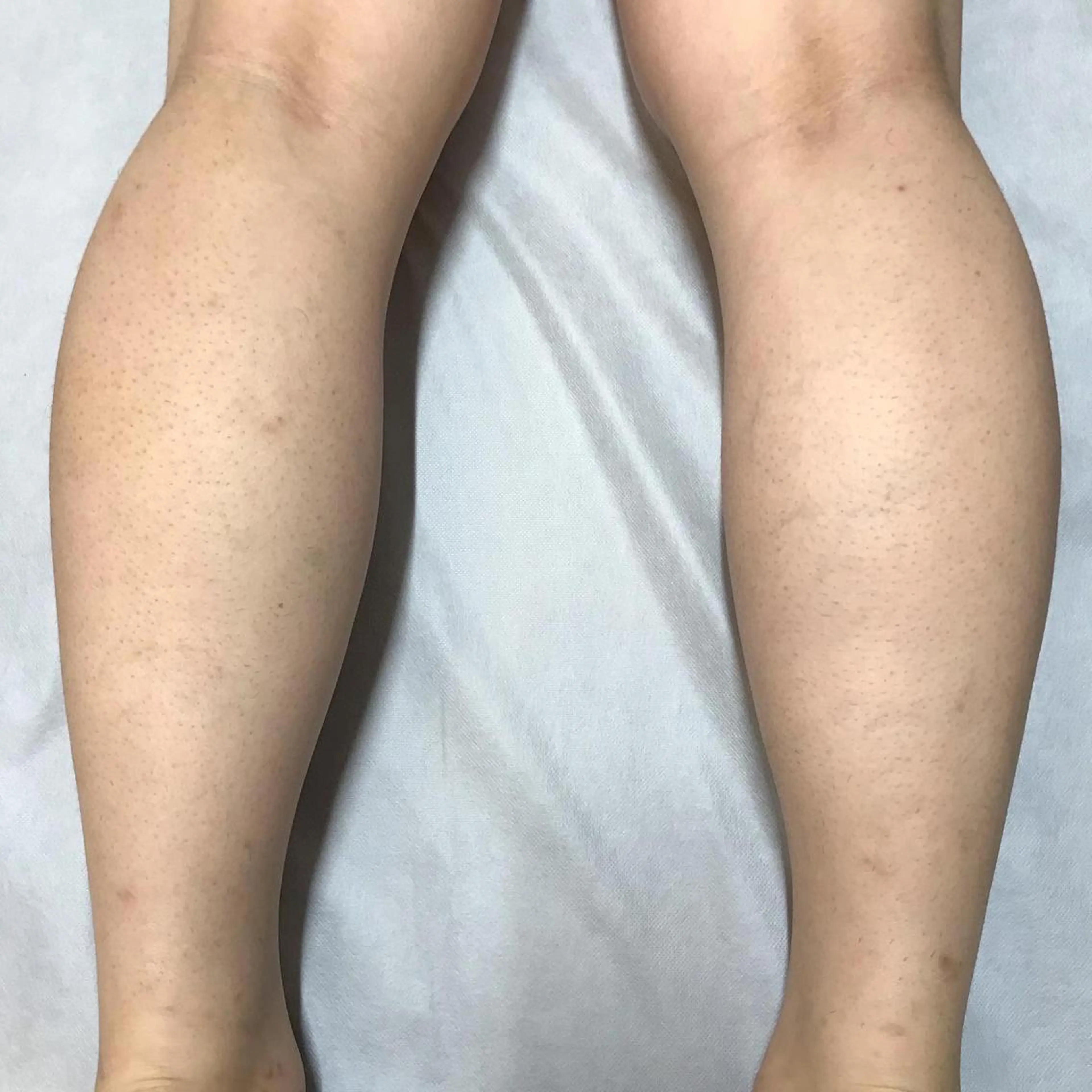 Lilyboo 星のエステ・リラクイメージ