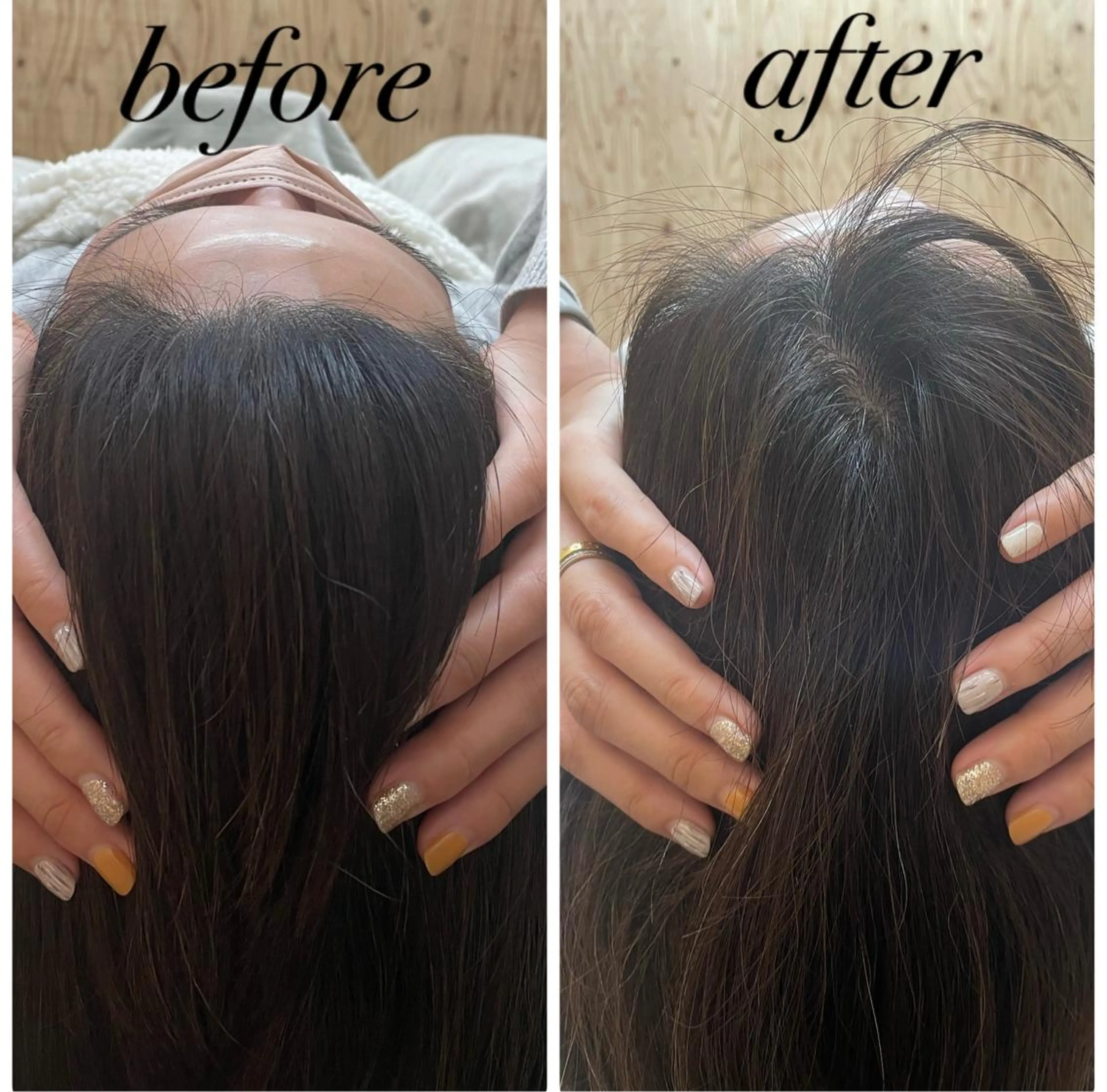 リラク ate'所属・個室ドライヘッドスパ 🍃moriのエステ・リラクイメージ