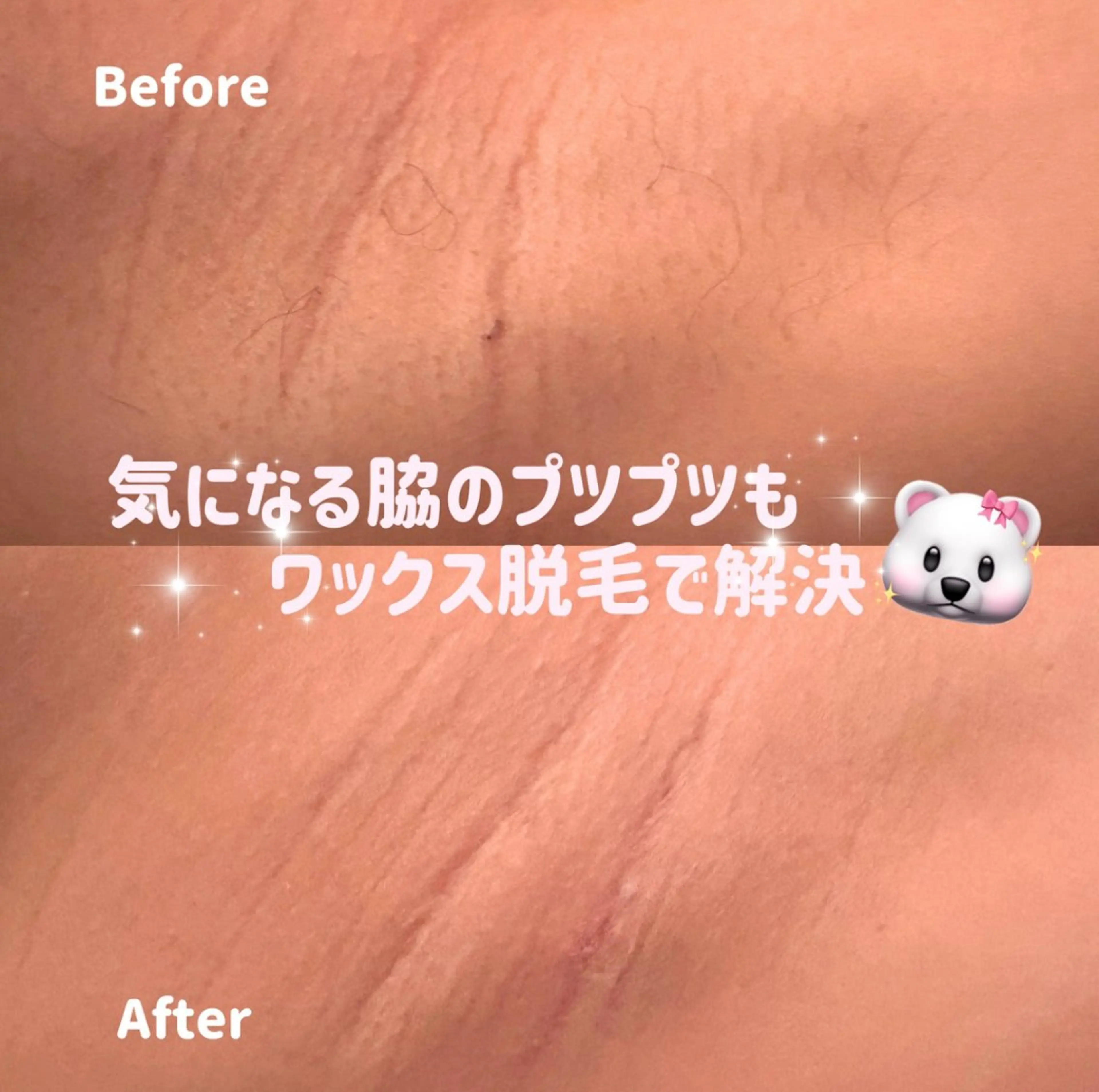 脱毛サロン COCOKANAの眉毛・アイブロウイメージ