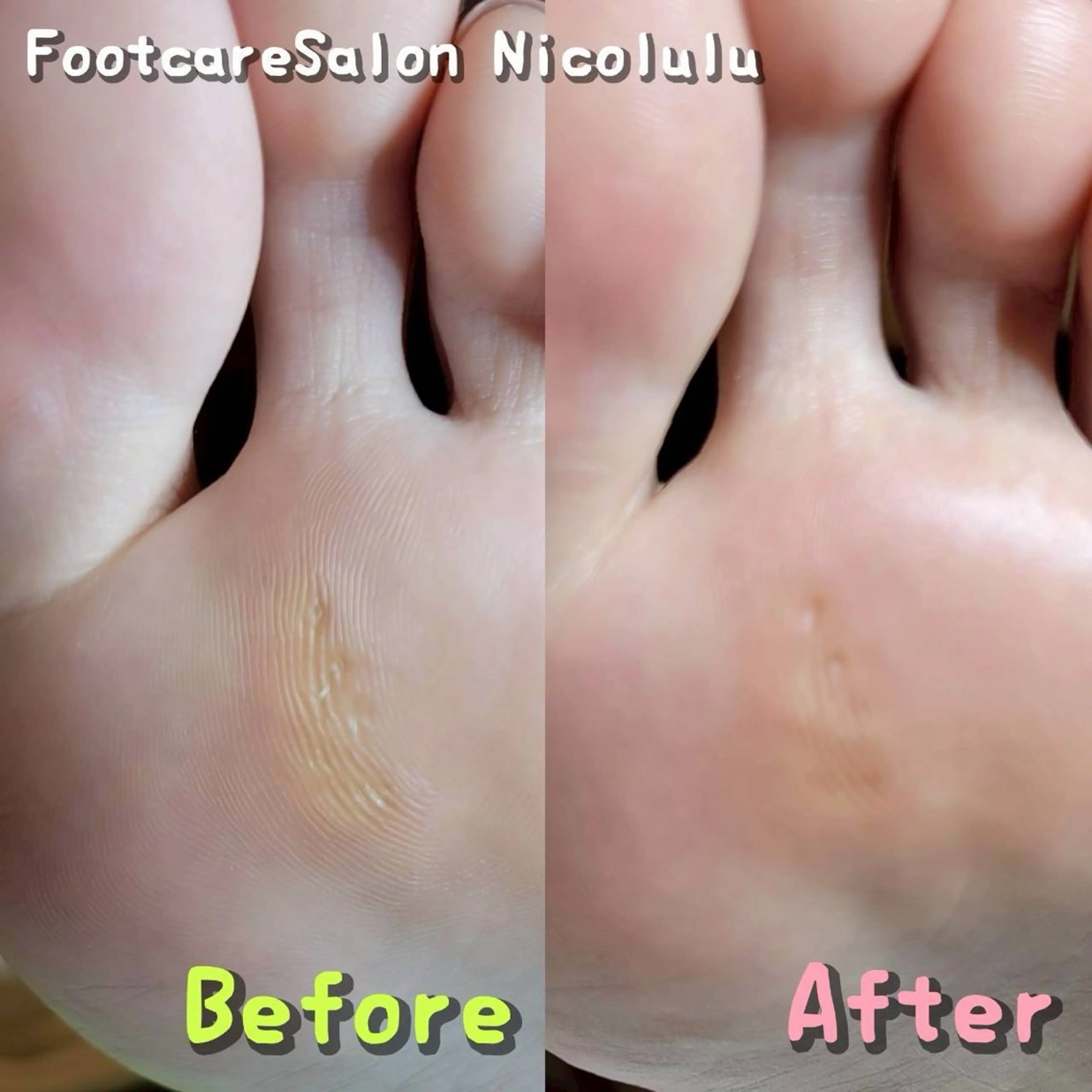 リラク 足トラブル専門 ニコルル金沢のエステ・リラクイメージ