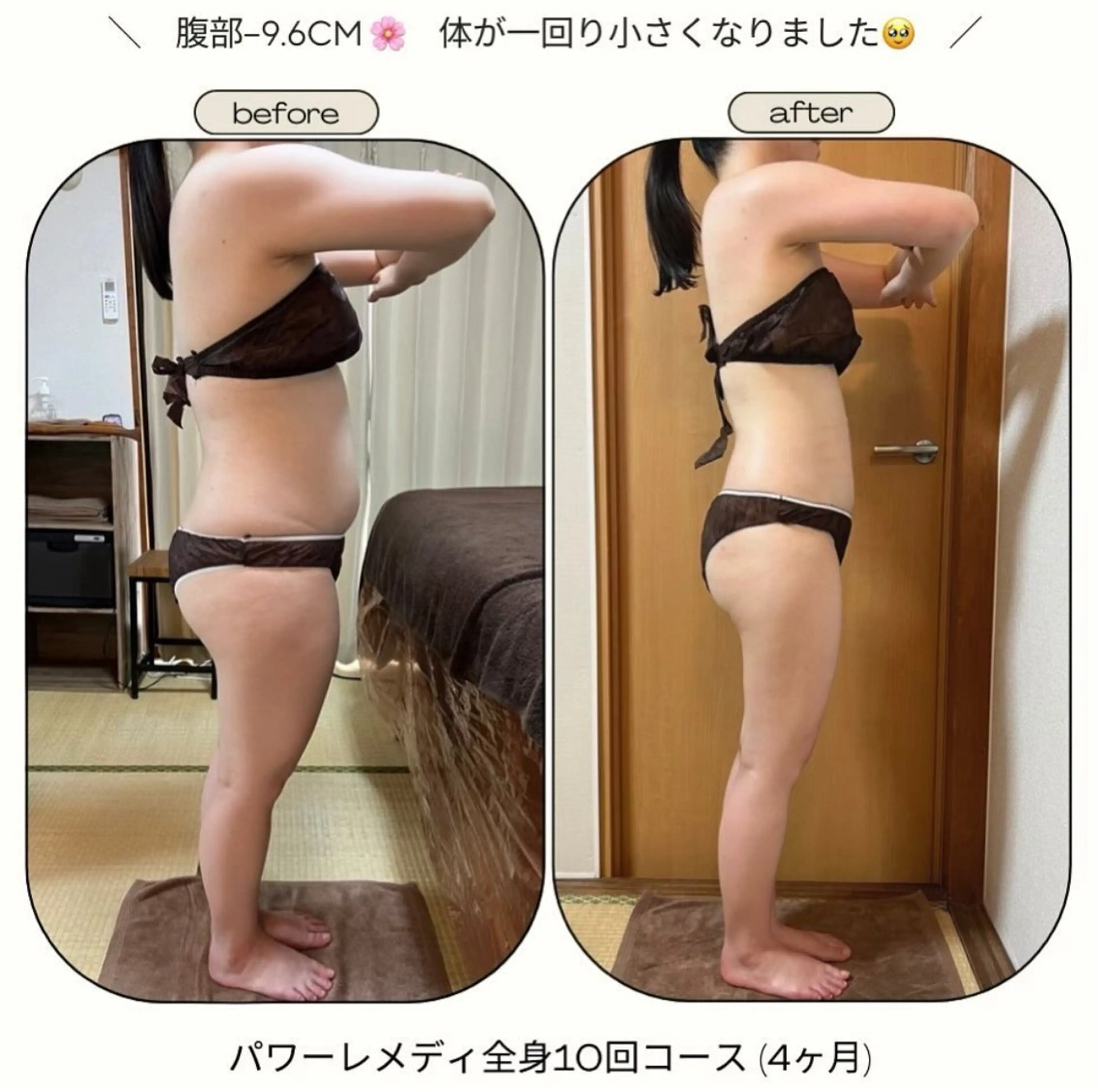 《本気痩せ×疲労改善 》  BILOOPのエステ・リラクイメージ