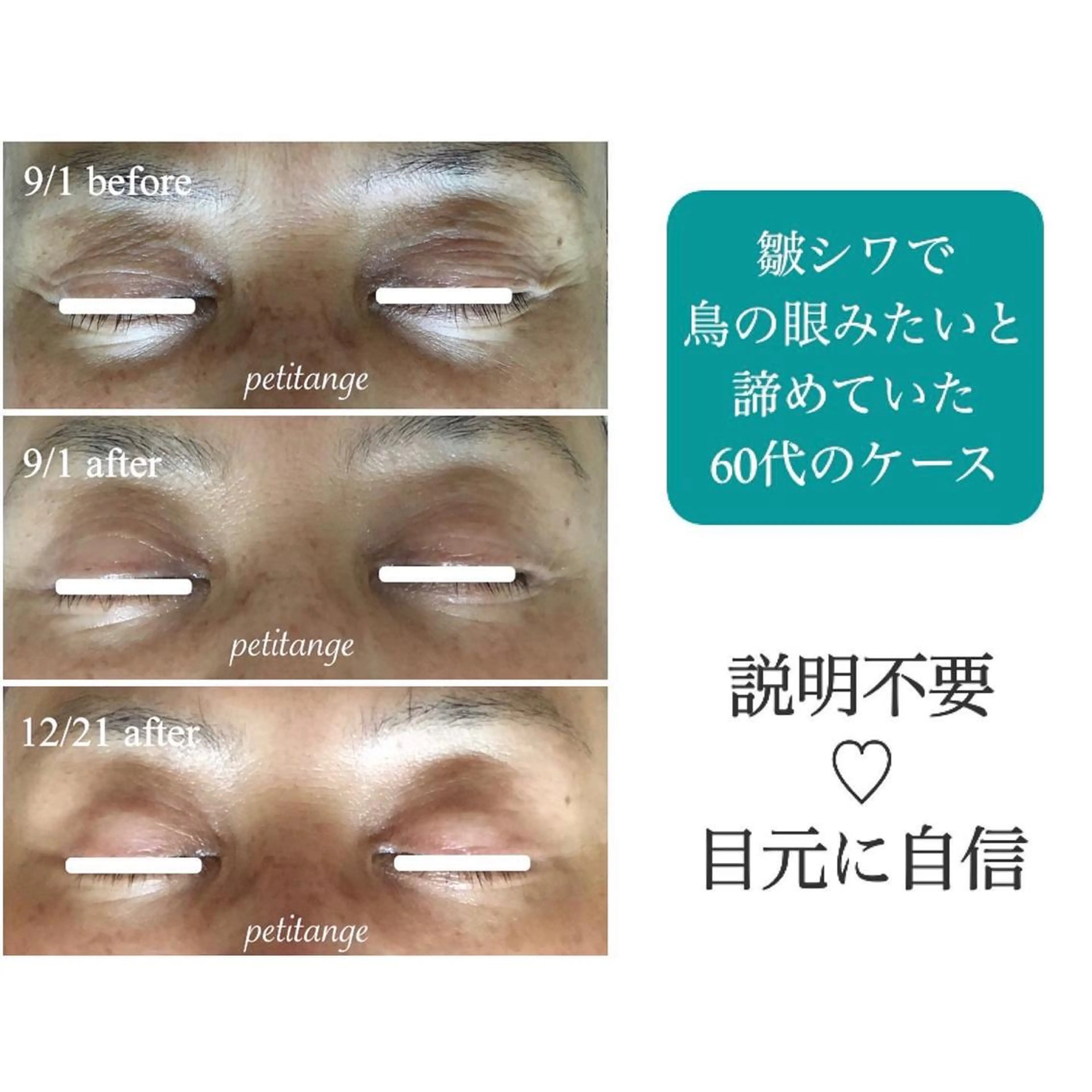 艶肌&小顔リフト❤︎ プチアンジェ茅ヶ崎のエステ・リラクイメージ