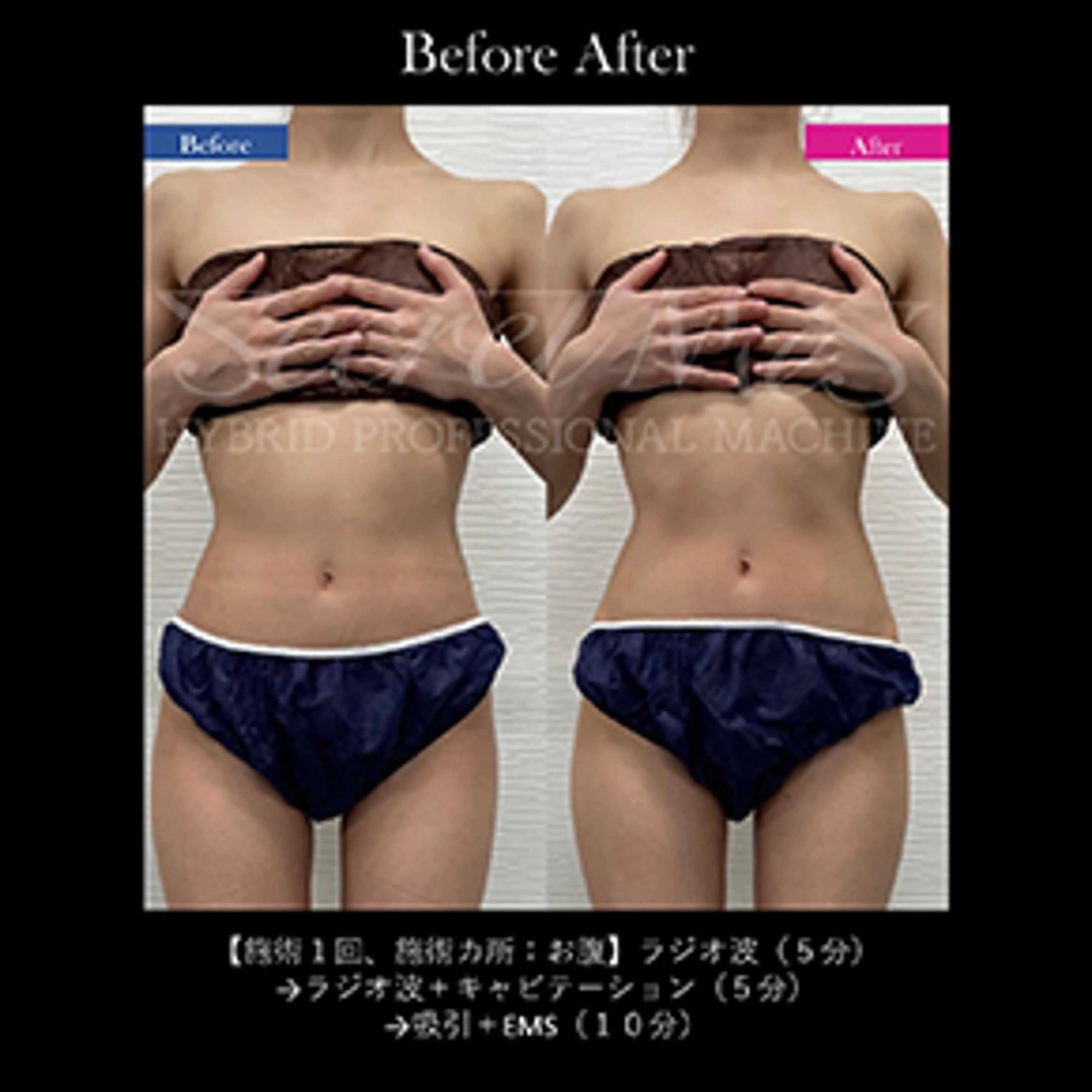 伊藤 正美のマツエク・マツパデザイン