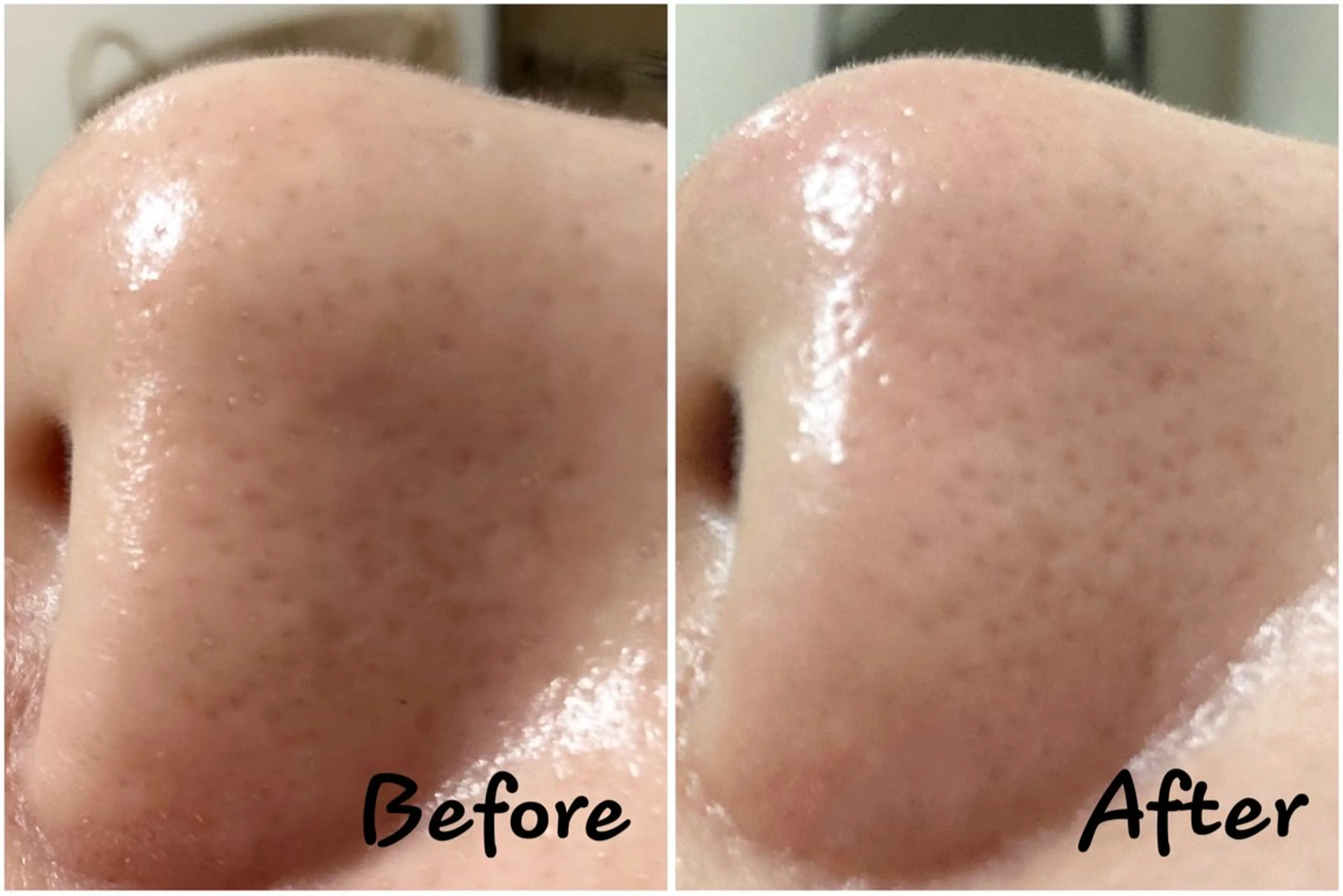 脱毛・ホワイトニング 耳ツボ・美白・毛穴のその他イメージ