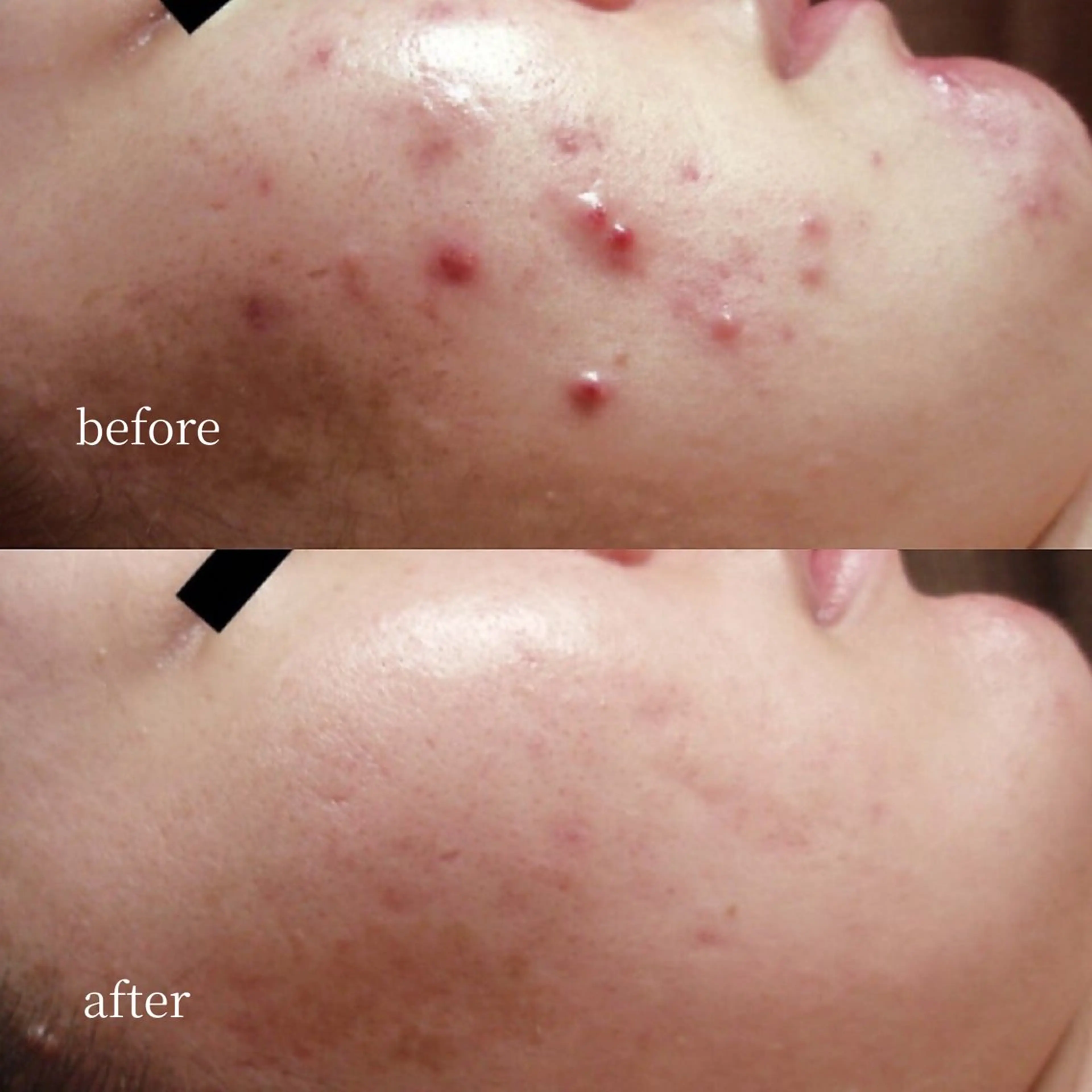 韓国肌管理・肌質改善 EARNEST心斎橋のエステ・リラクイメージ