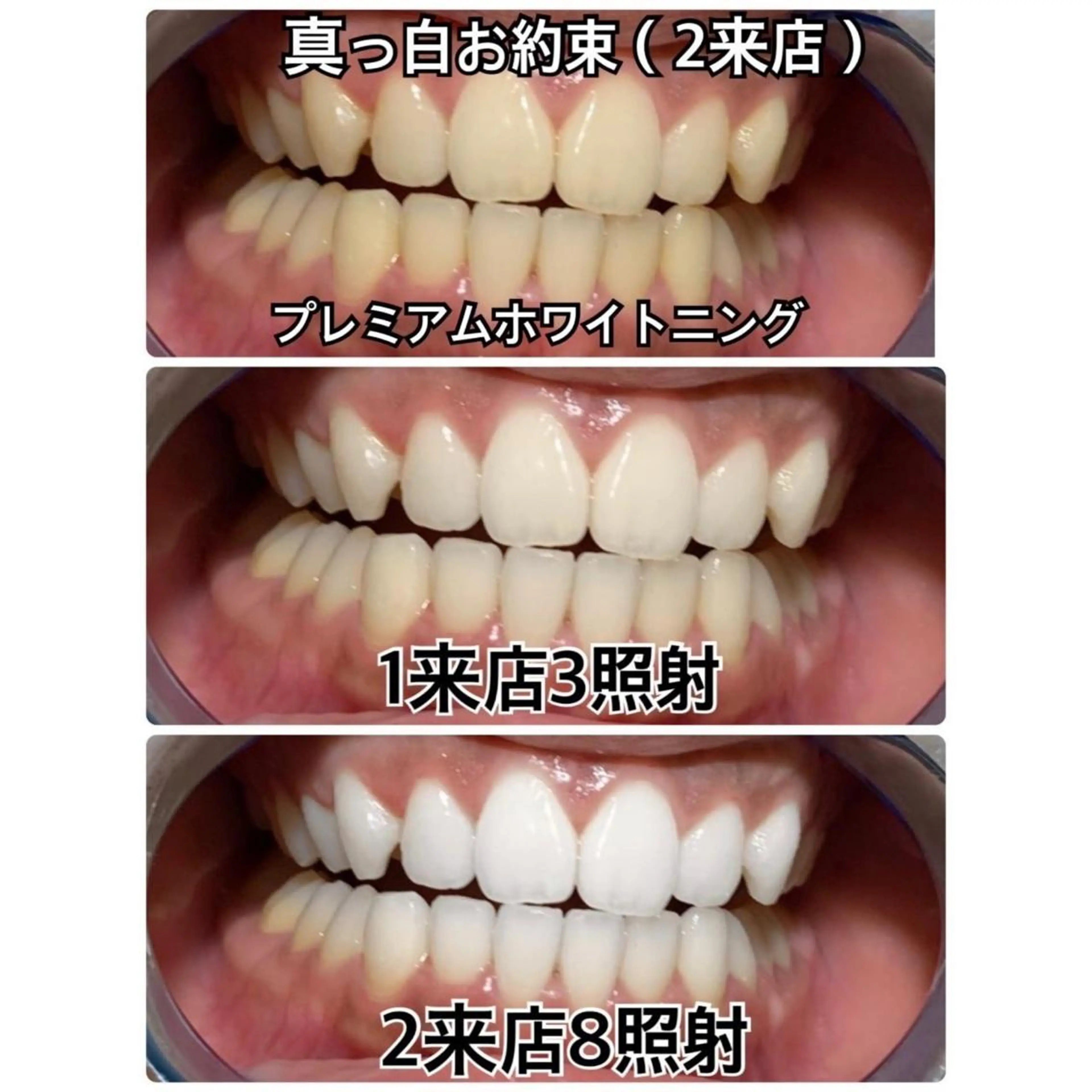 メンズ プラチナムビューティー柏所属・【歯科提携】柏ホワイ トニングスタイルのその他イメージ