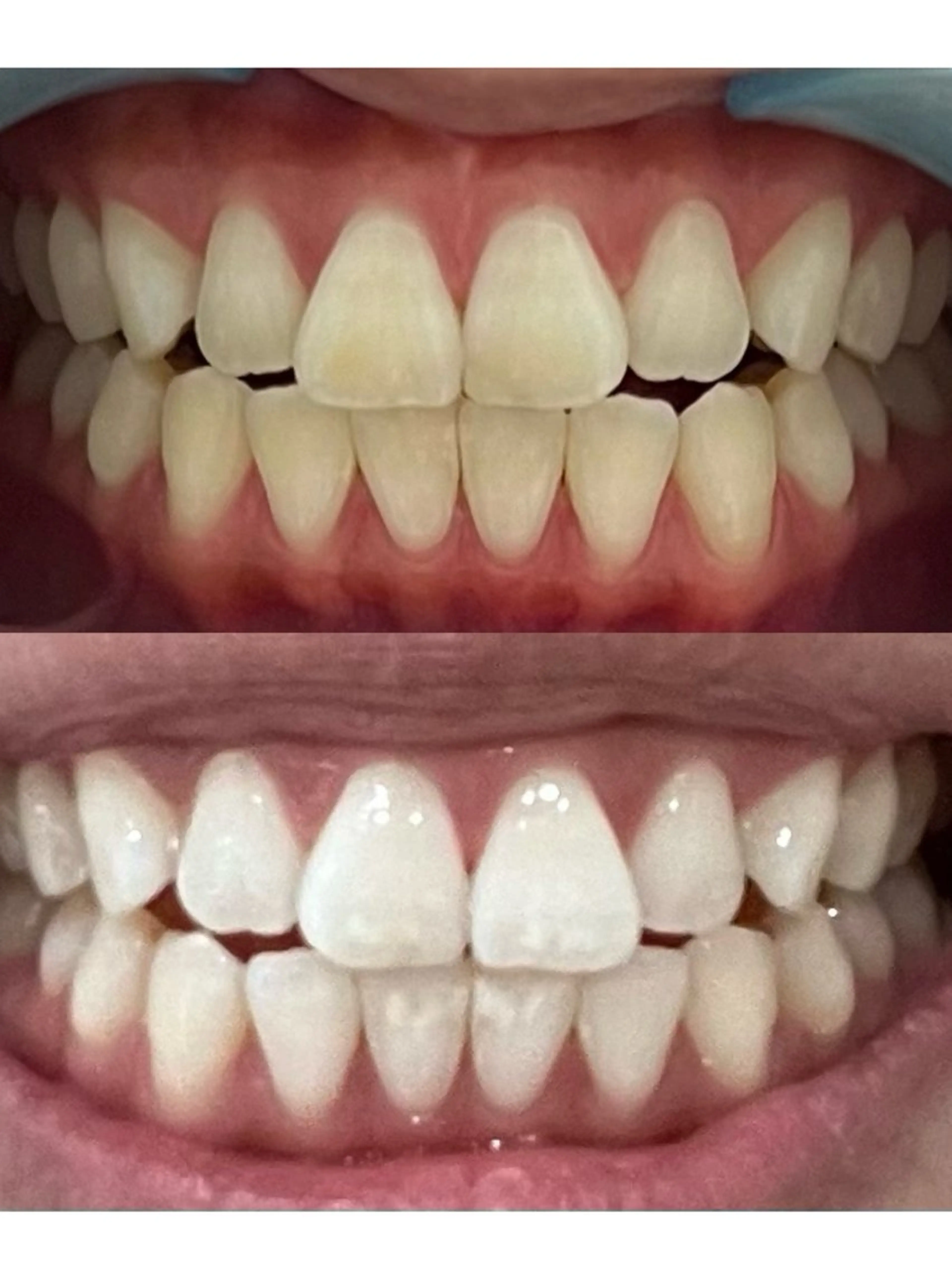 その他 𝐑𝐞𝐯𝐢𝐨 ___堺市西区のマツエク・マツパデザイン