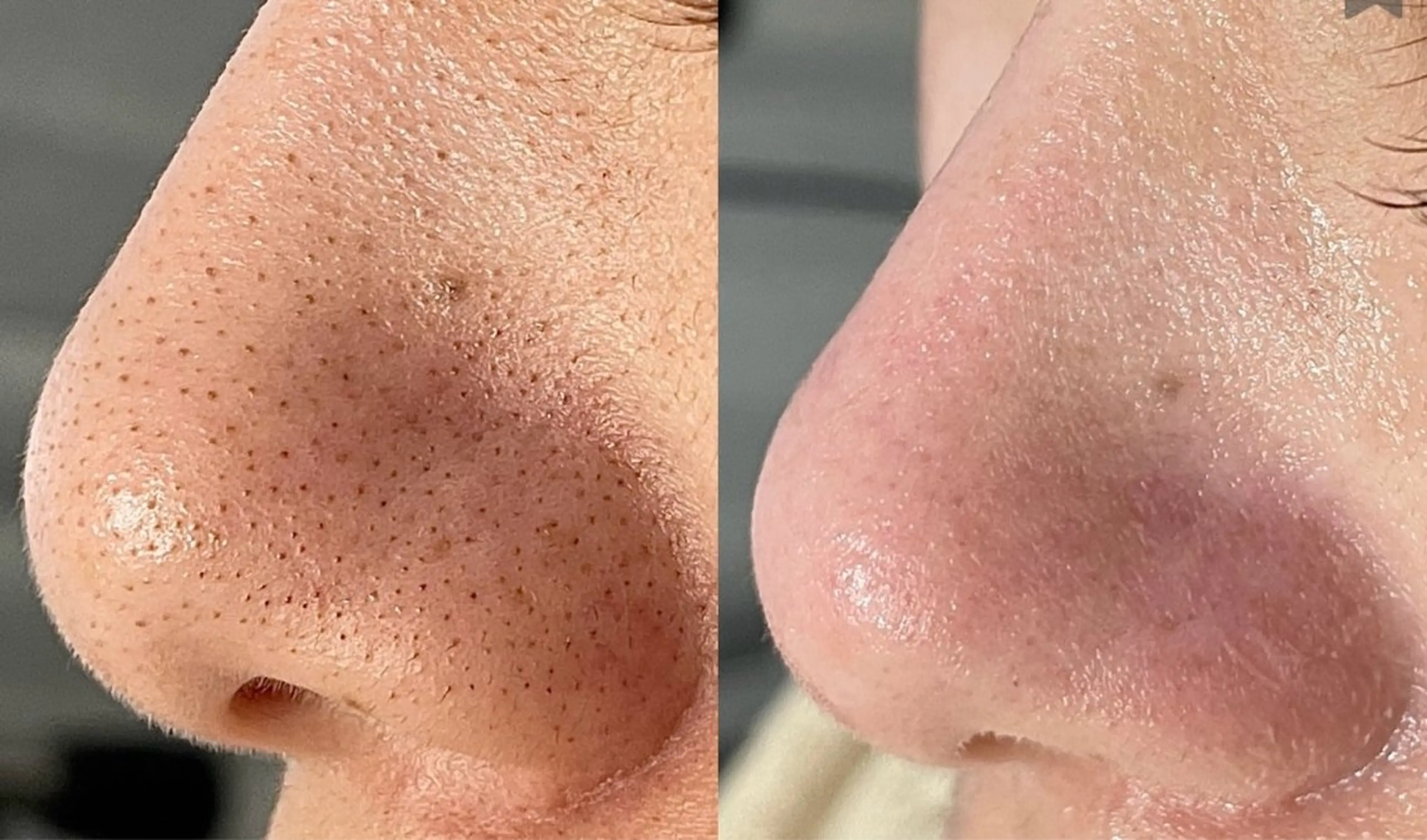 le verre久屋公園所属・le verre 久屋公園のネイルデザイン