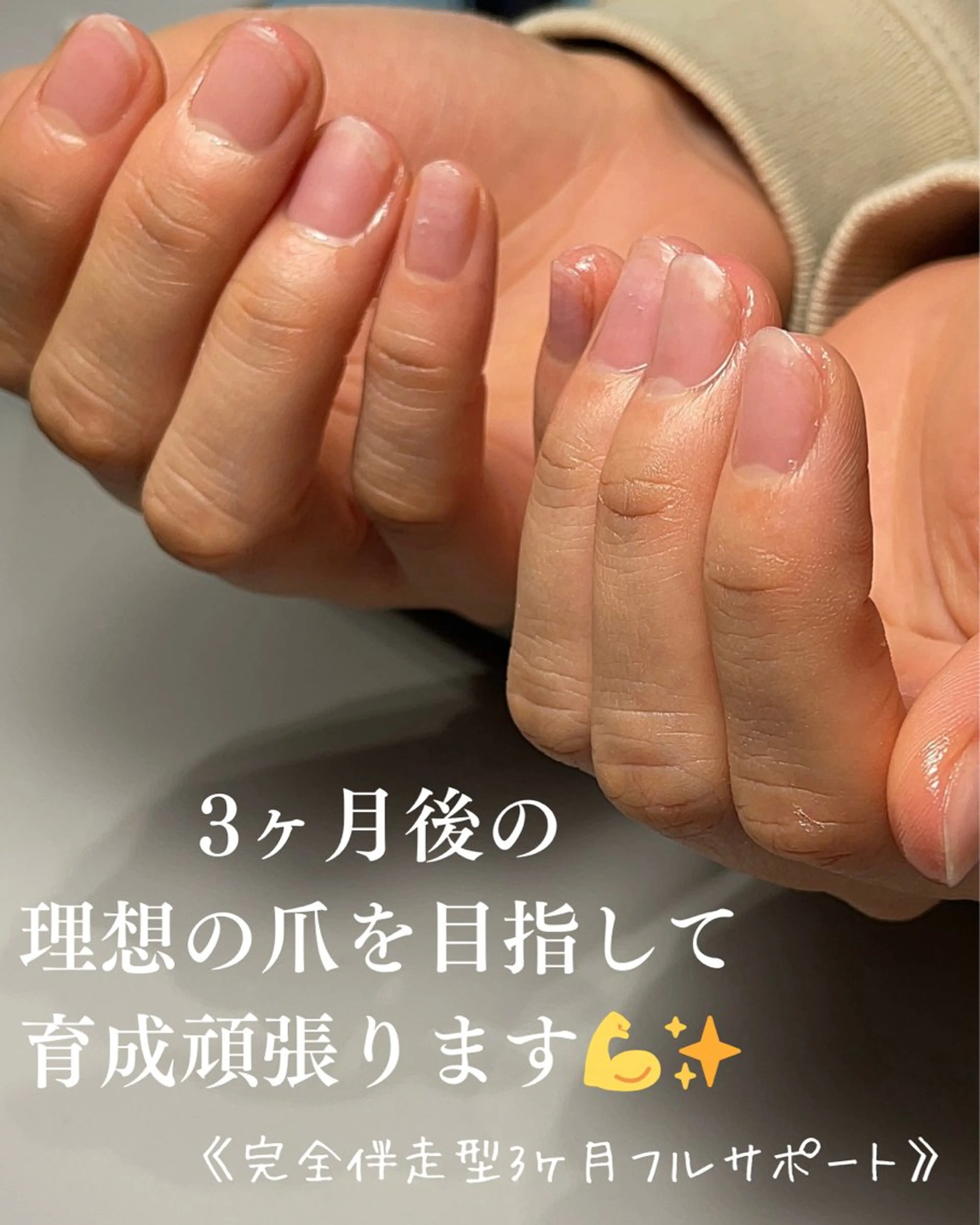 ネイル Aim* 深爪自爪育成専門店のネイルデザイン