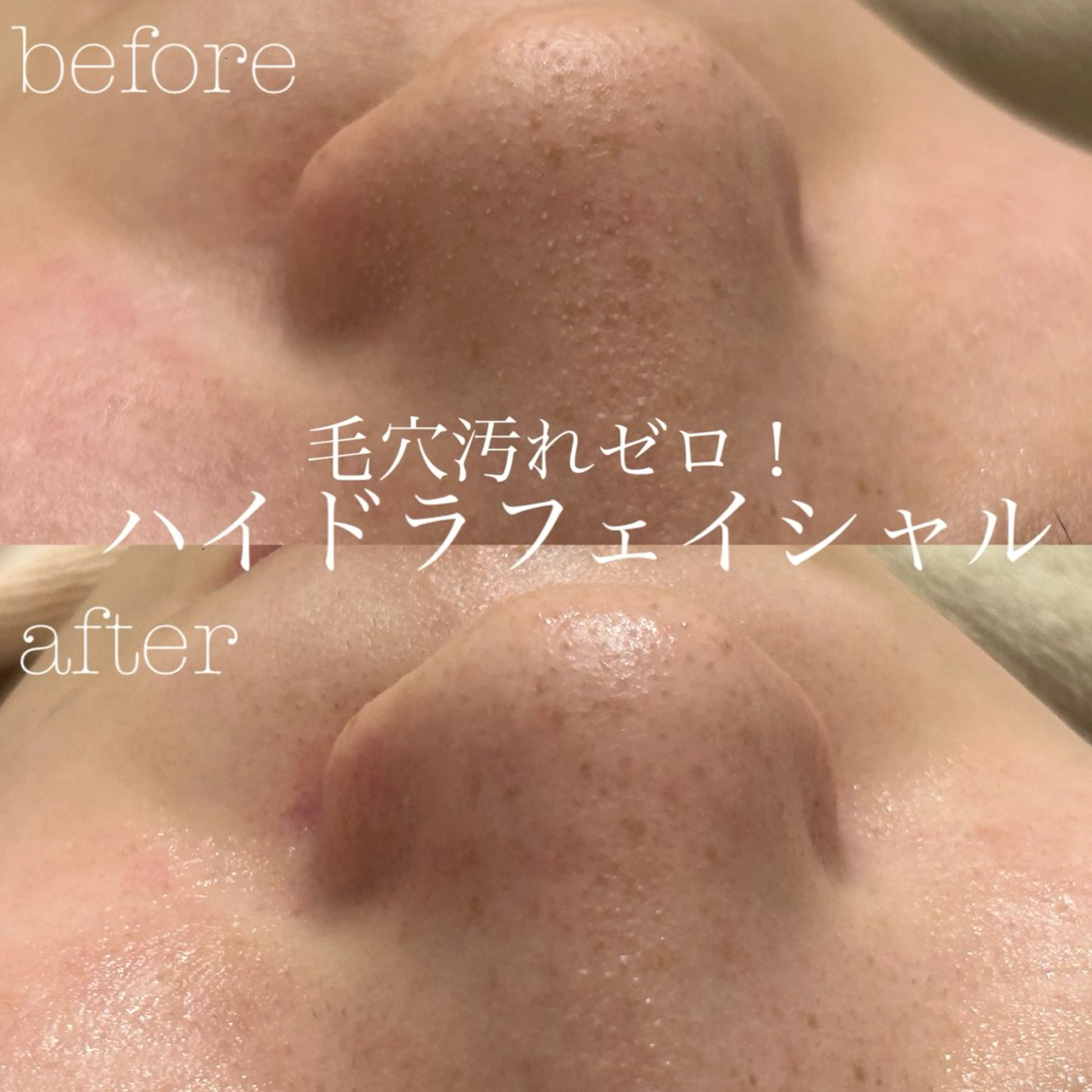 エステ フェイシャルサロン CHIARA 荒田のエステ・リラクイメージ