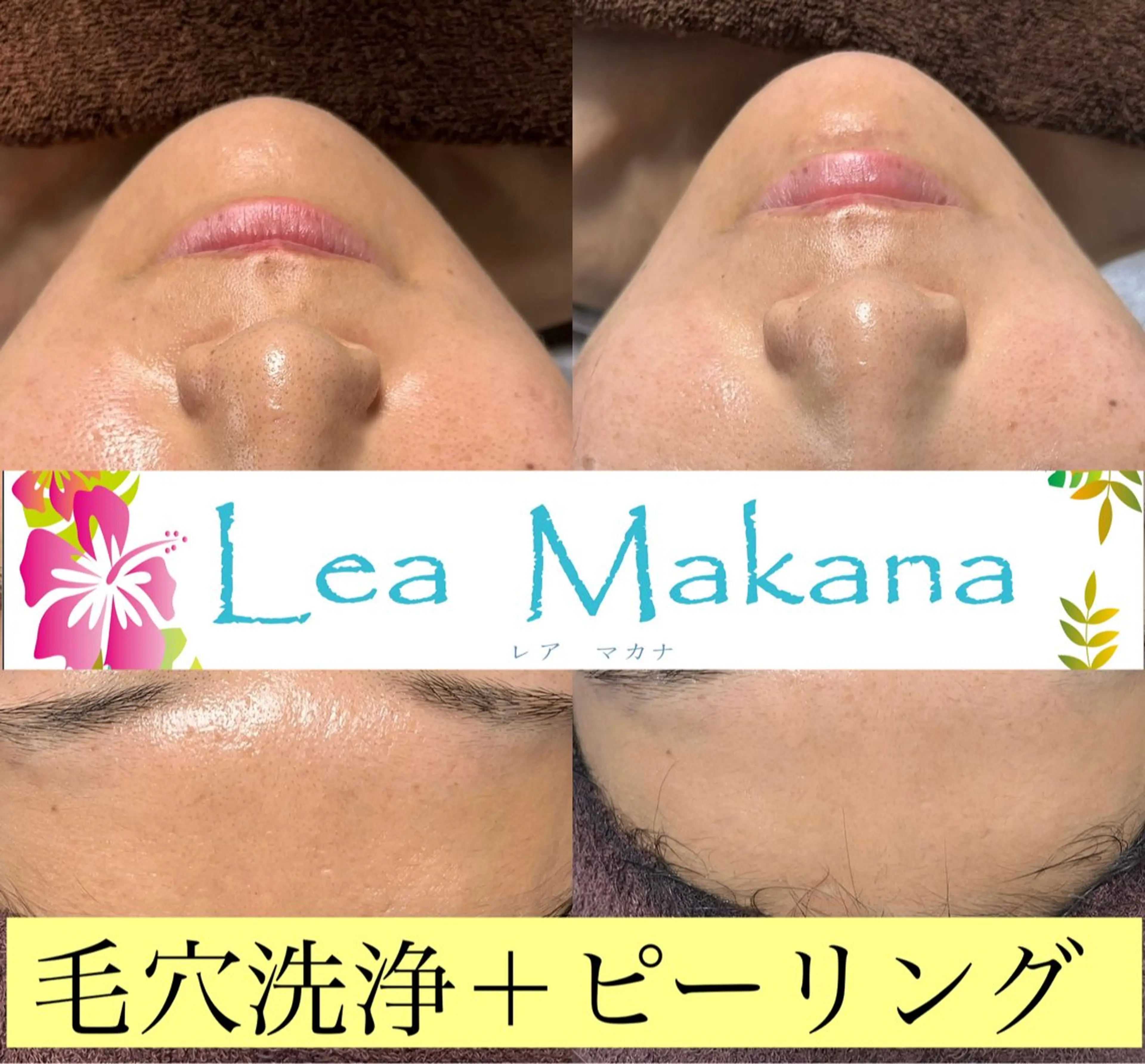 エステ 毛穴洗浄🍀脱毛🍀 光フェイシャル🍀のエステ・リラクイメージ