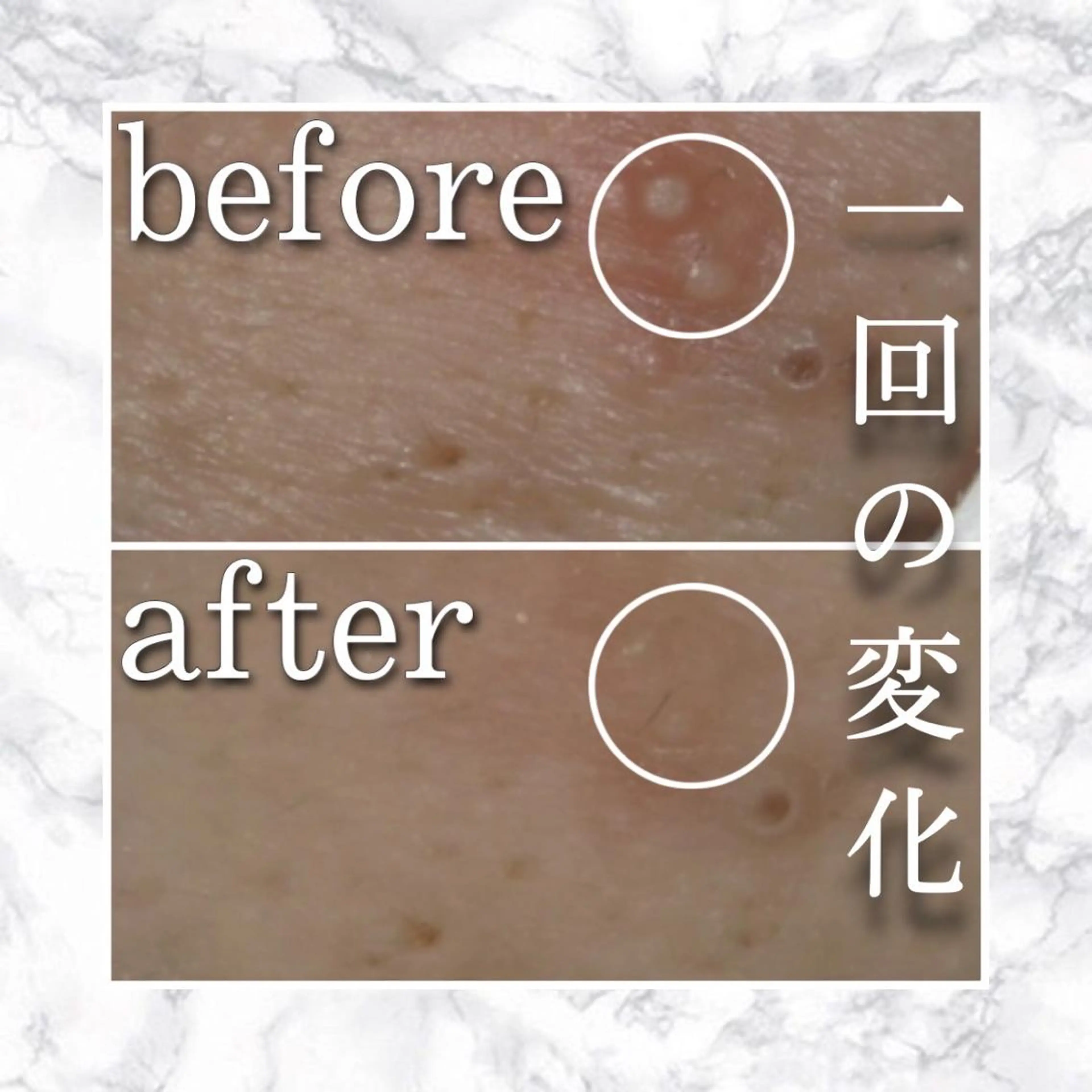 ショート カラー パーマ ヘアアレンジ メンズ キッズ ネイル マツエク・マツパ アイブロウ ニキビ特化型エステ 🍋最短で肌質改善のエステ・リラクイメージ