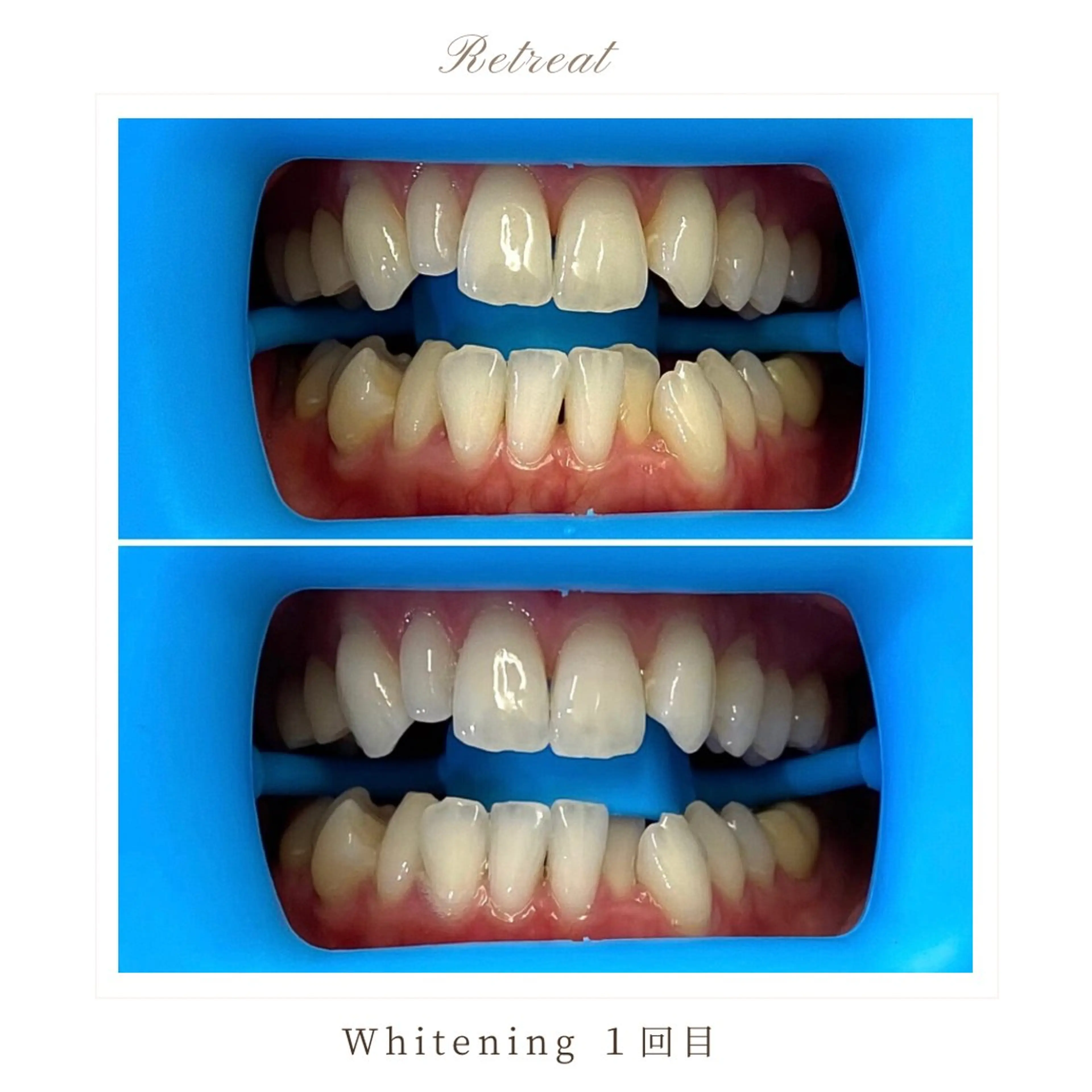 Retreatリトリート所属・歯科医院提携 Retreatのエステ・リラクイメージ