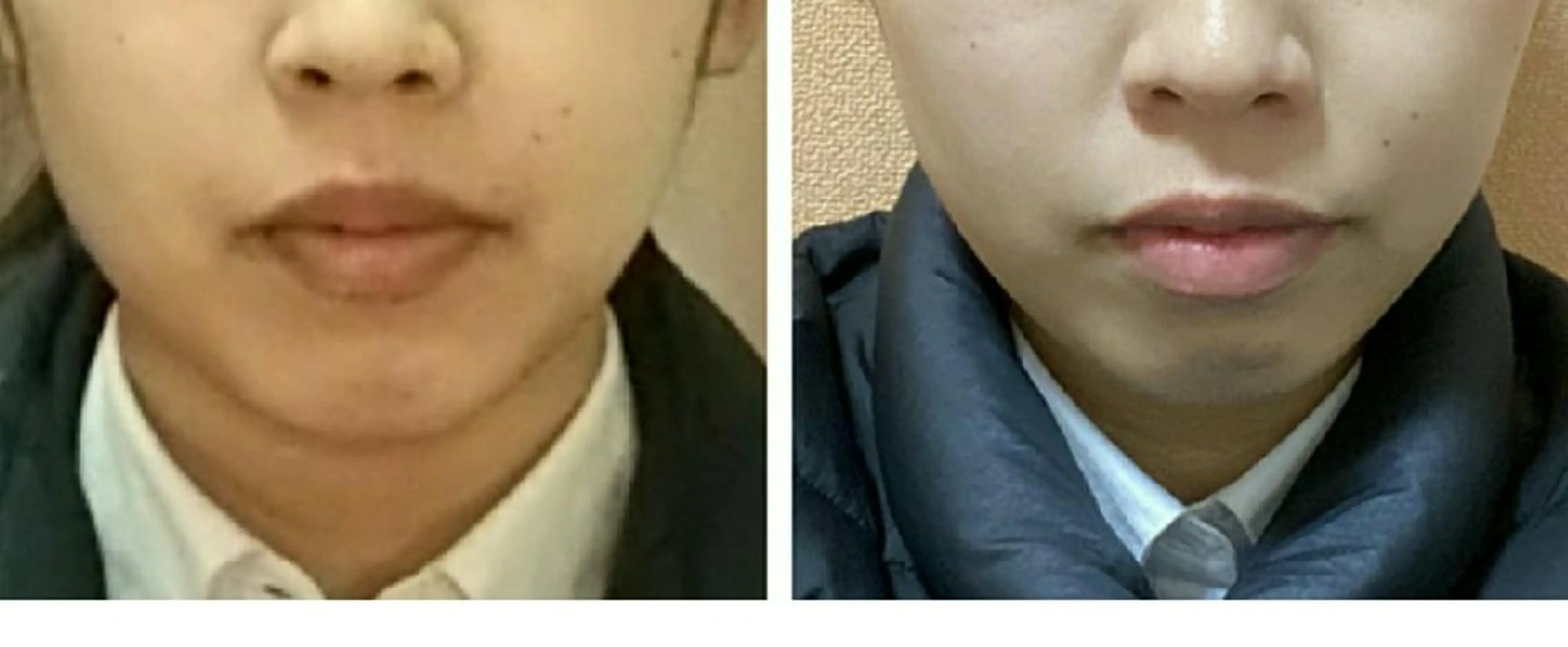 小顔と美肌 まごころエステMatoria所属・小顔 美肌専門 Matoriaのエステ・リラクイメージ