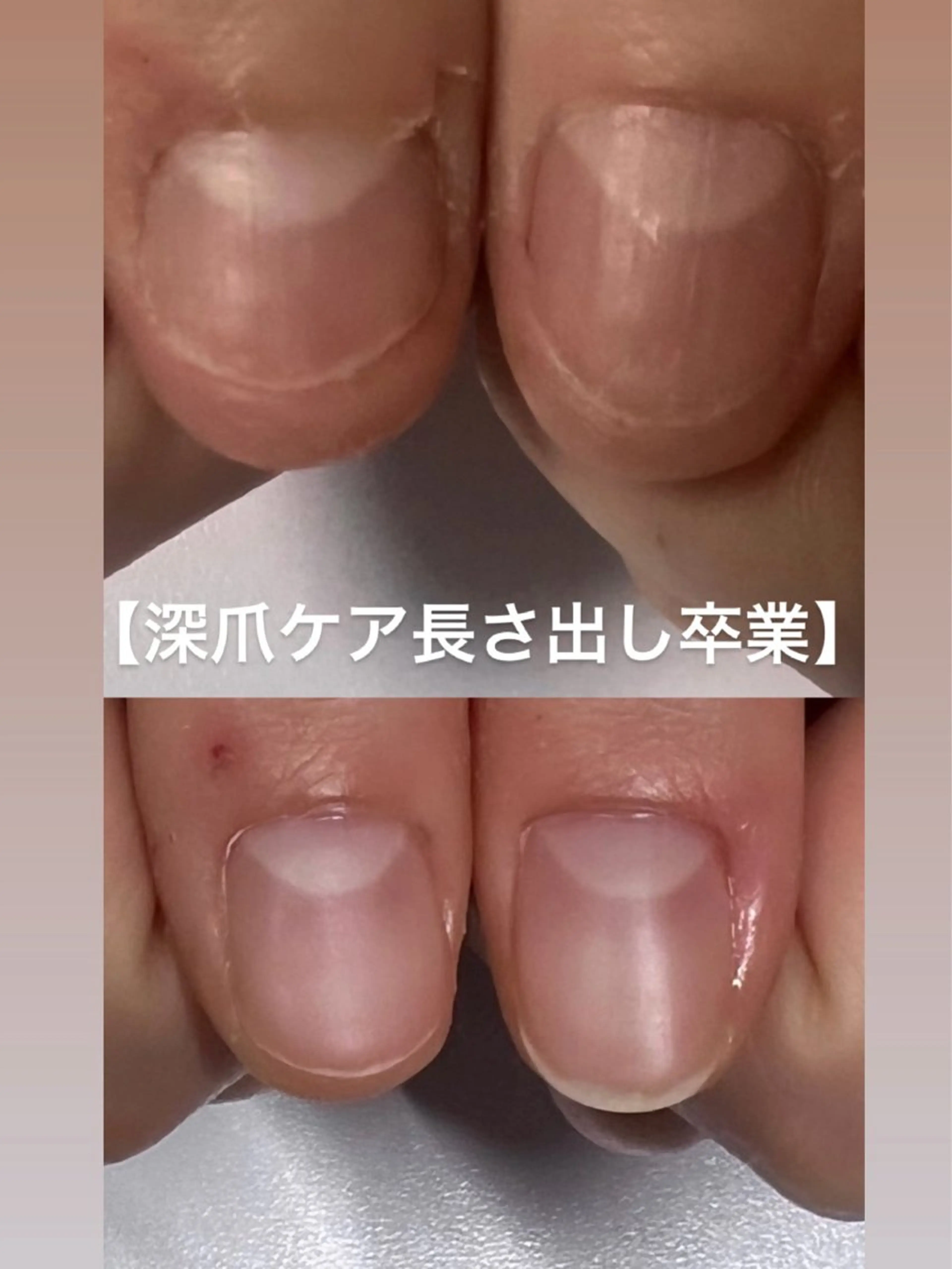 メンズ ネイル ハンドネイル 爪ケア/深爪 自爪育成 🐰えむのネイルデザイン