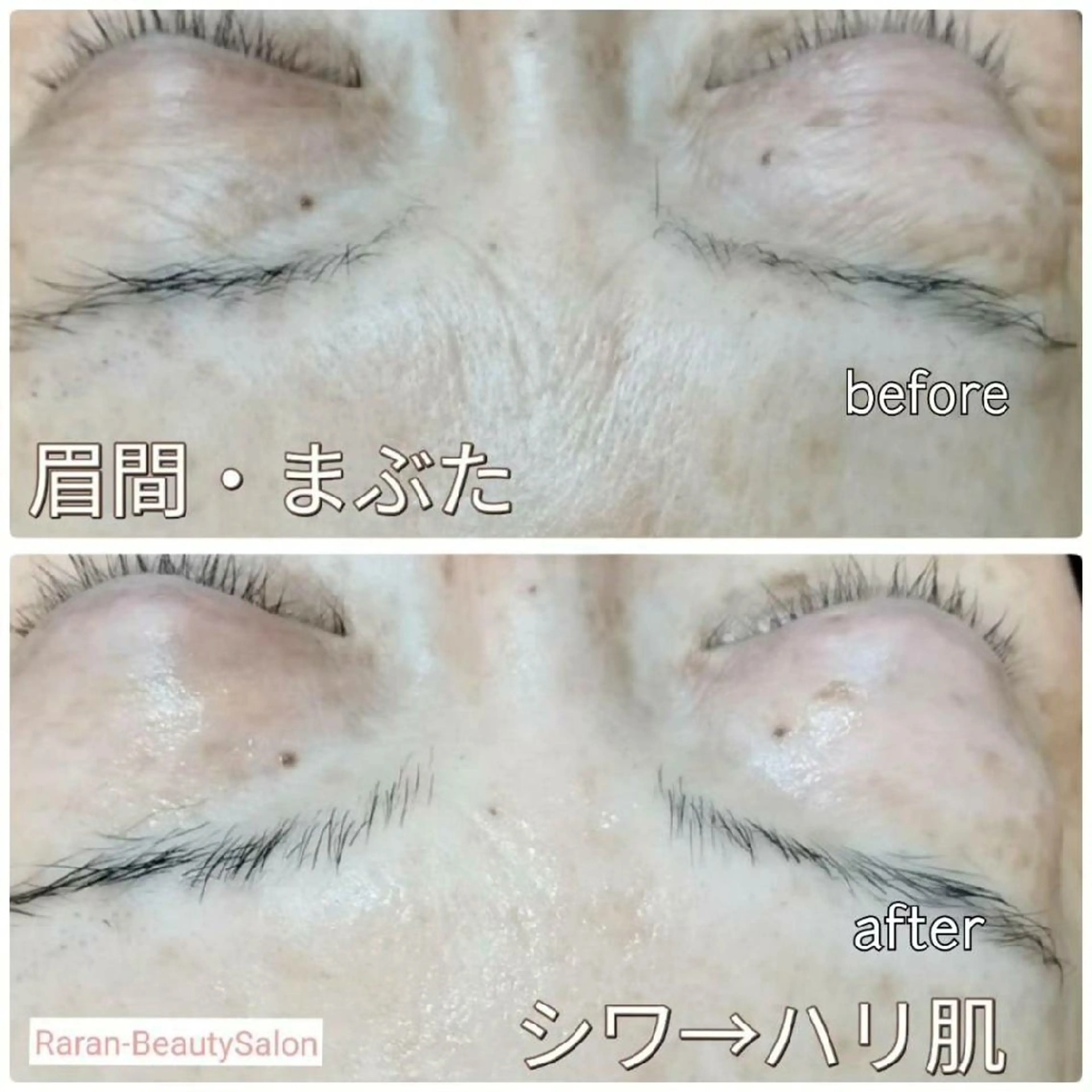 若返り 美肌   エステサロンららんのエステ・リラクイメージ