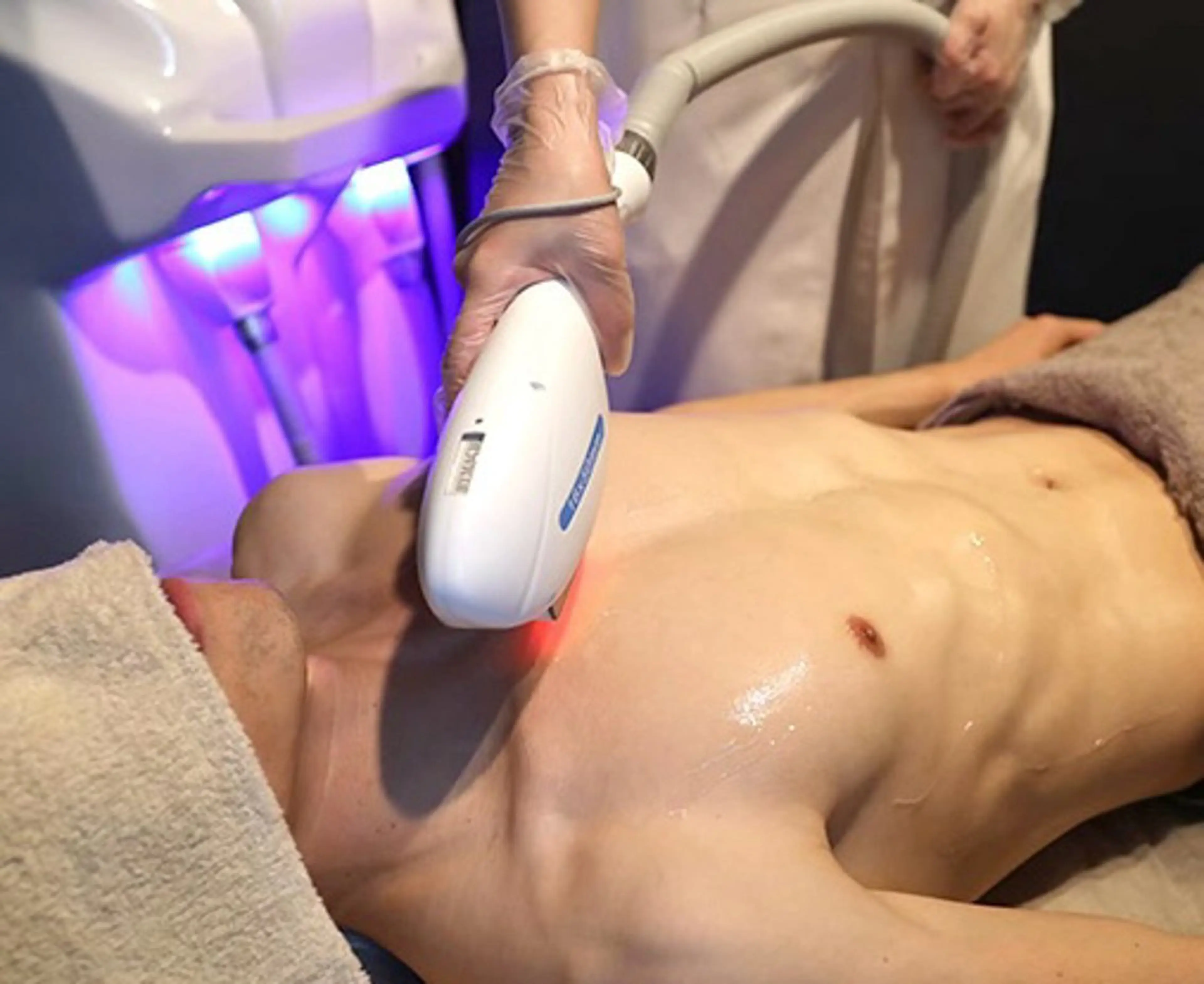 【男性限定】メンズ光全身脱毛(VIO込み)✨の写真
