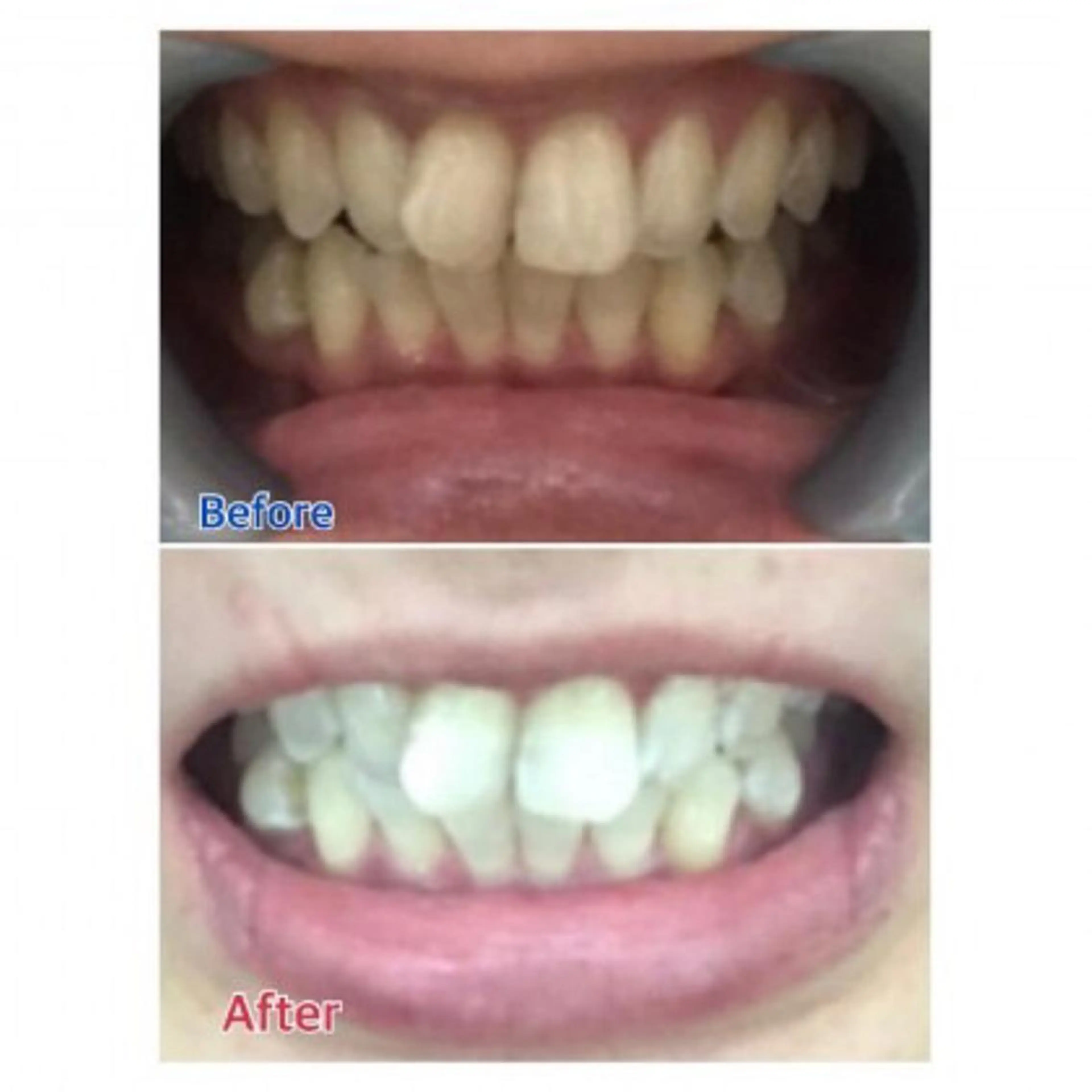 Ｍ渋谷 ホワイトニングのエステ・リラクイメージ