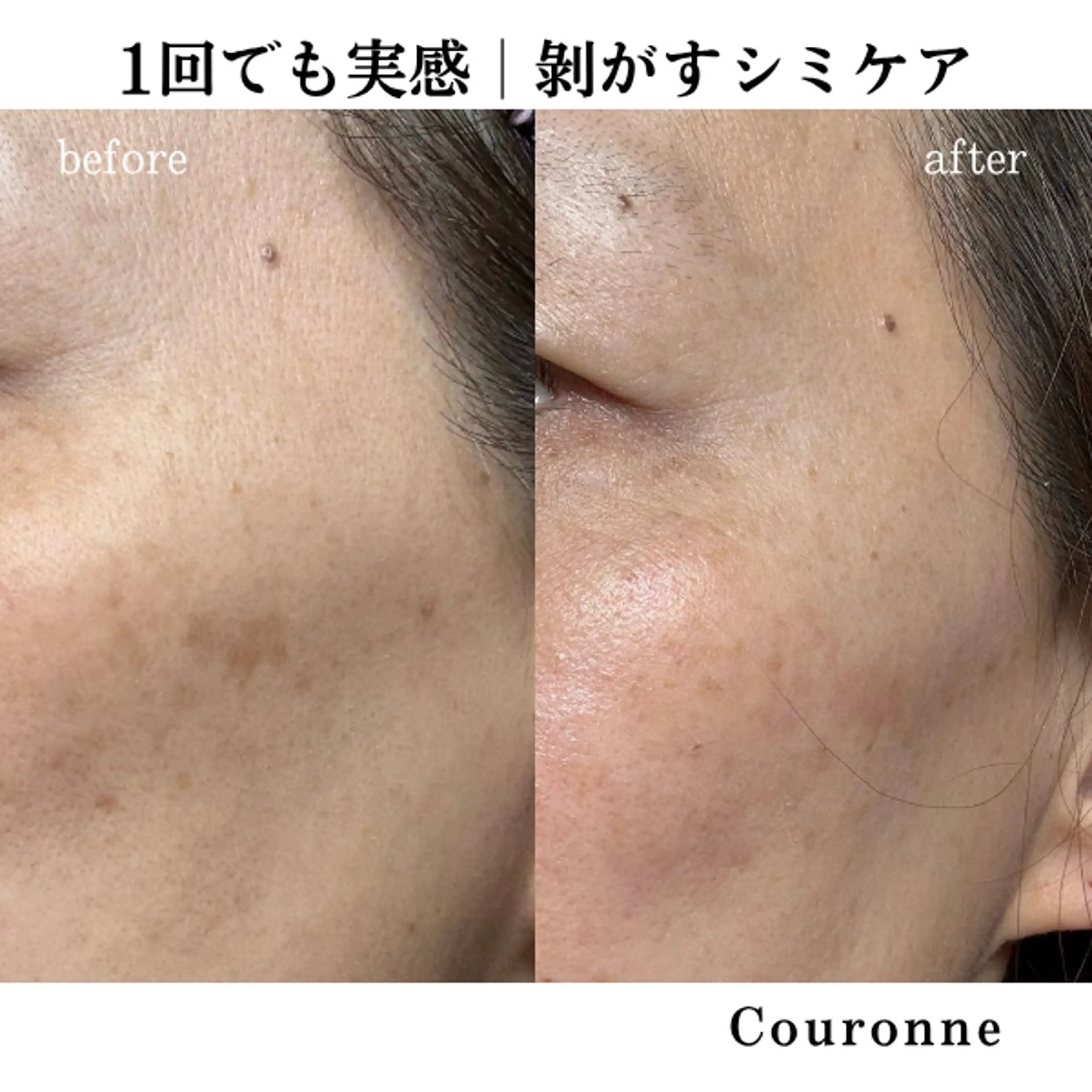 エステ シミ・毛穴ケア専門 クロヌYUKIのエステ・リラクイメージ