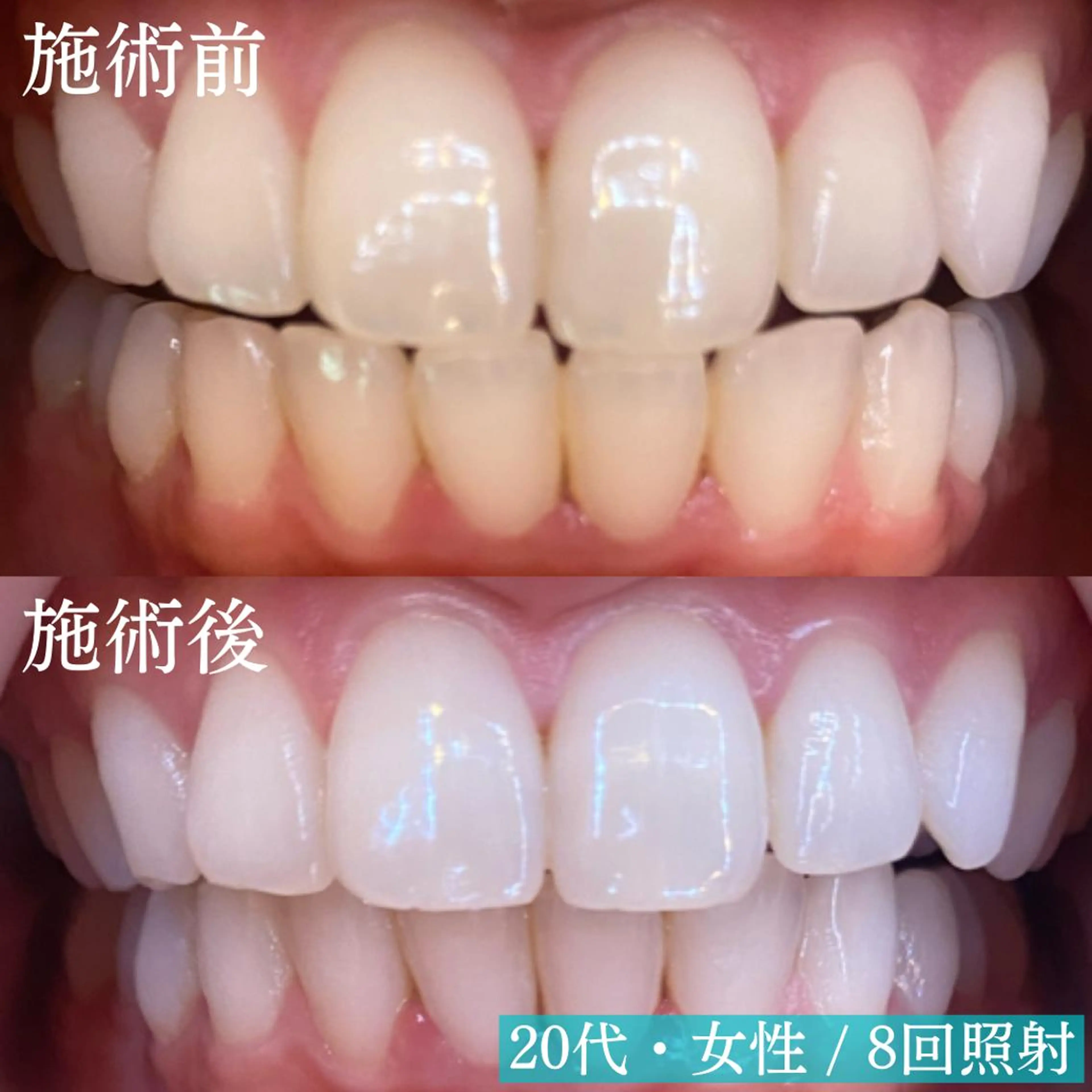 その他 LBSホワイトニング 新宿店💎公式のその他イメージ