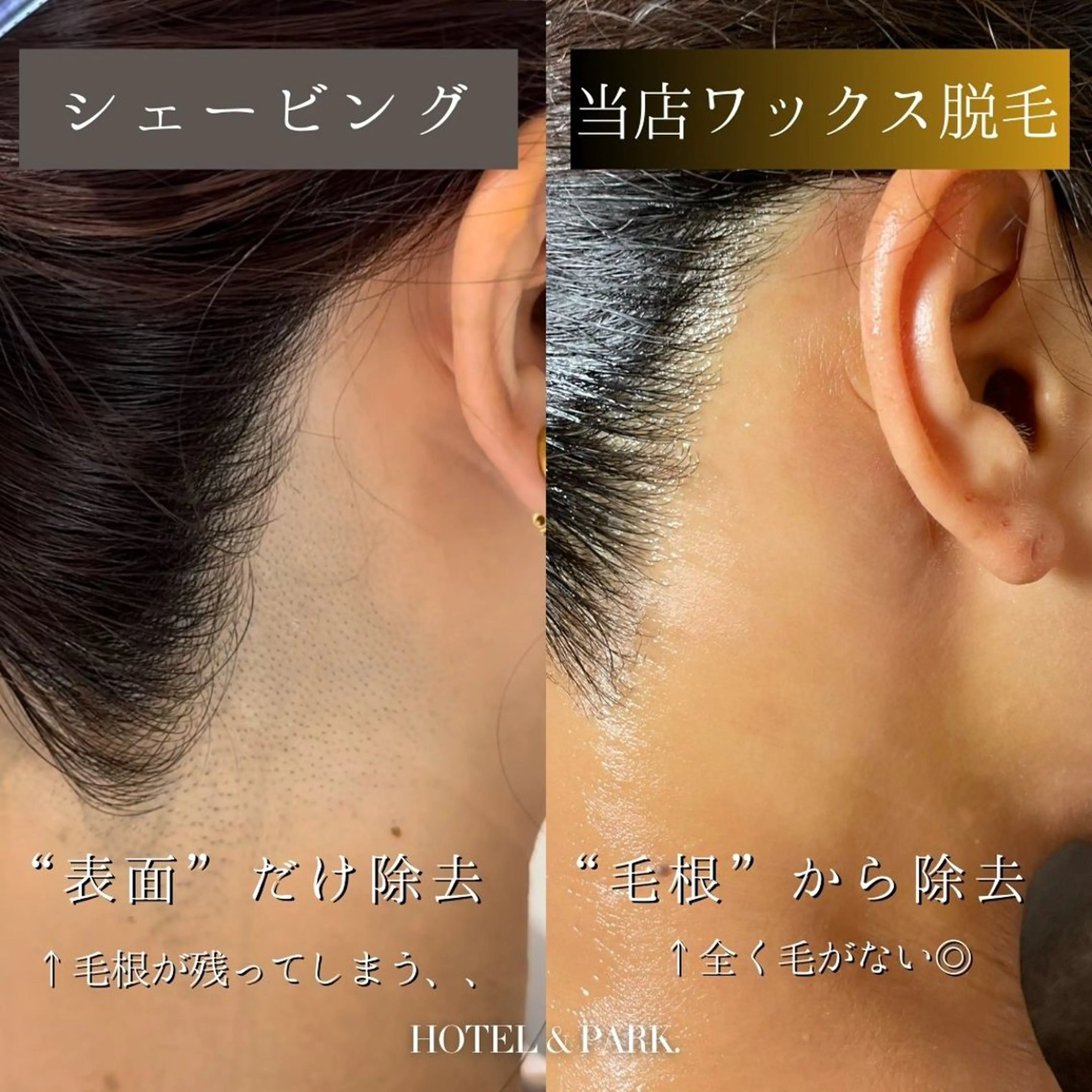 HOTEL&PARK . ワックス脱毛のエステ・リラクイメージ