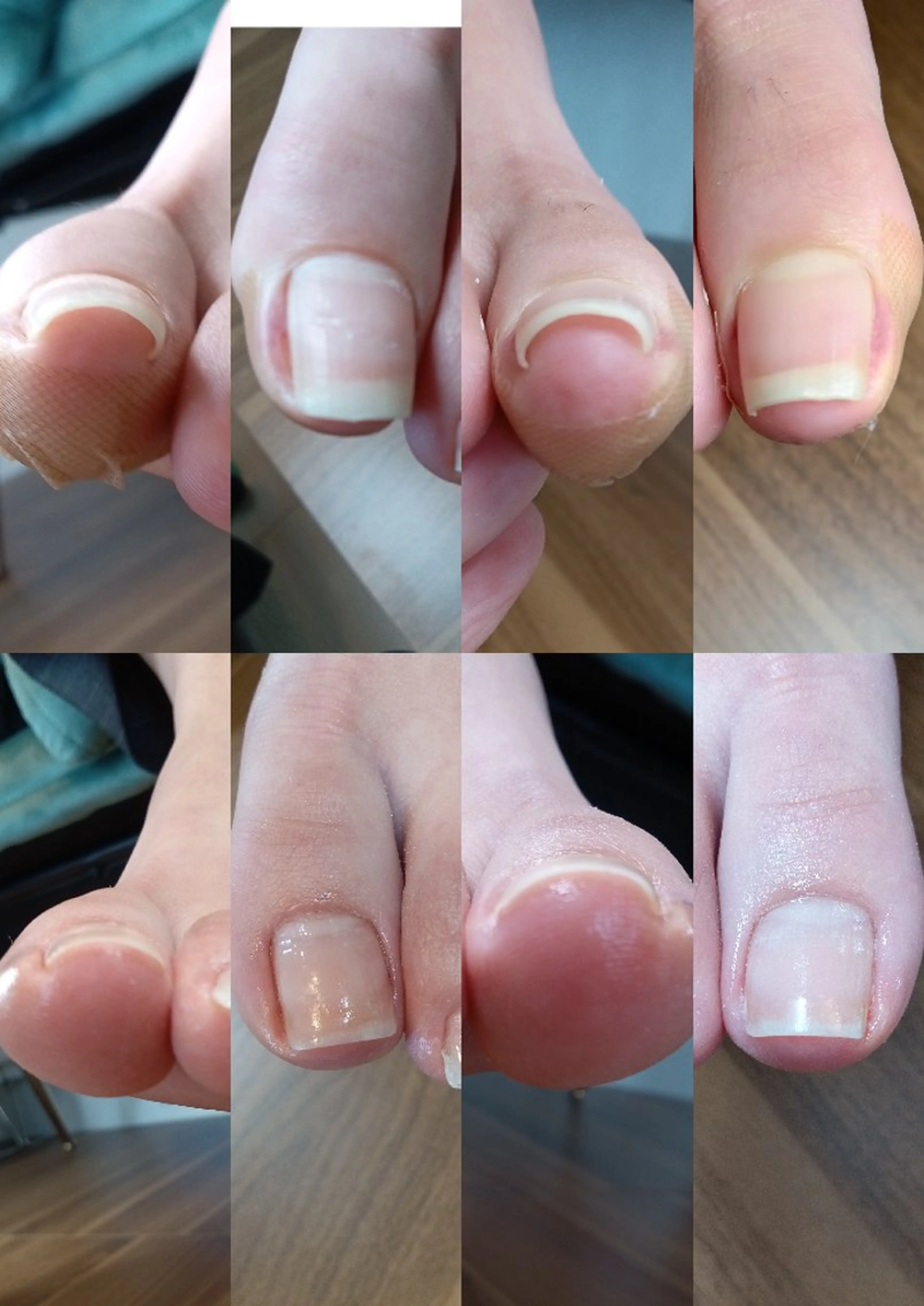 ネイル その他 フットケアルーム ~KaPilina~のネイルデザイン