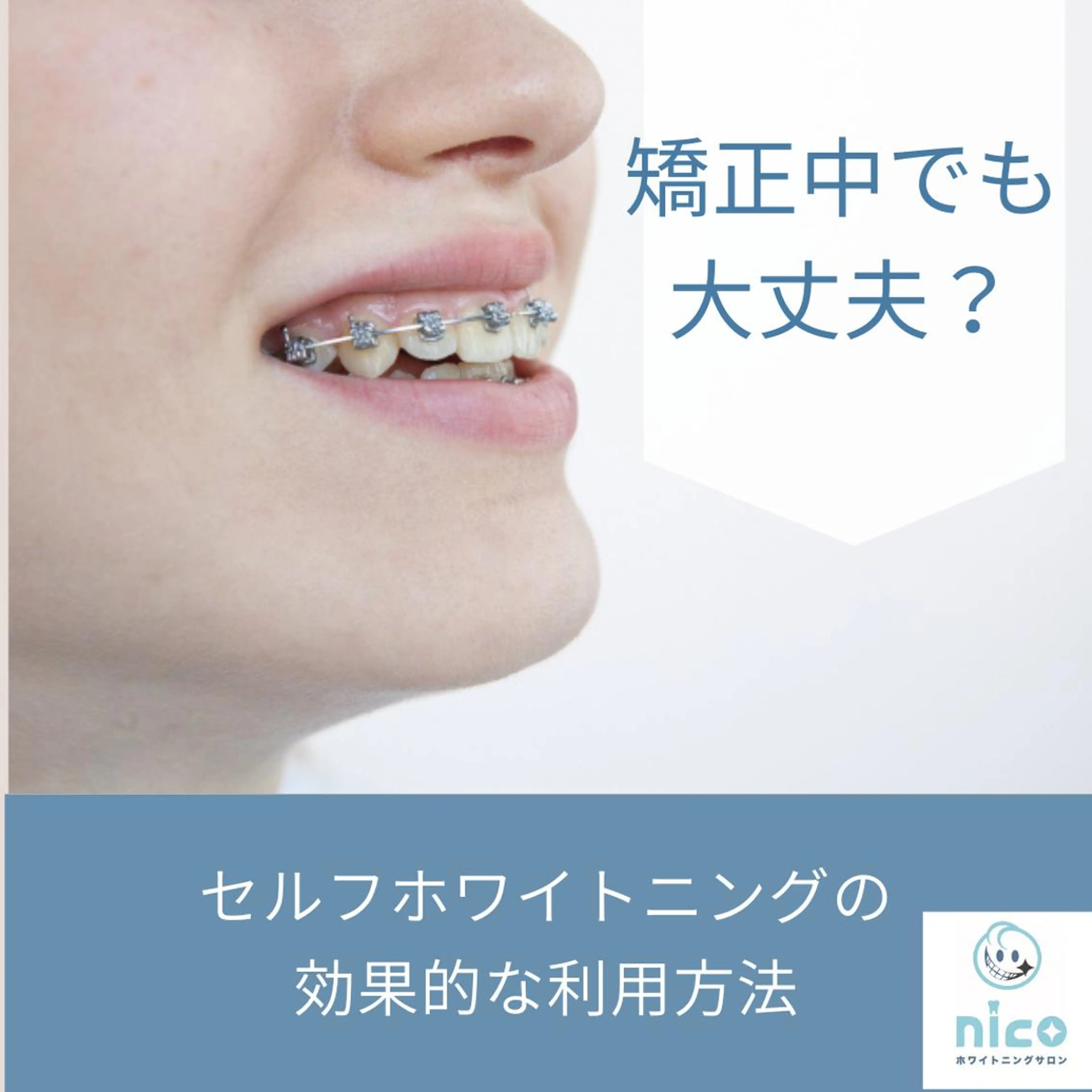 セミロング ホワイトニングサロン nico西葛西店のその他イメージ