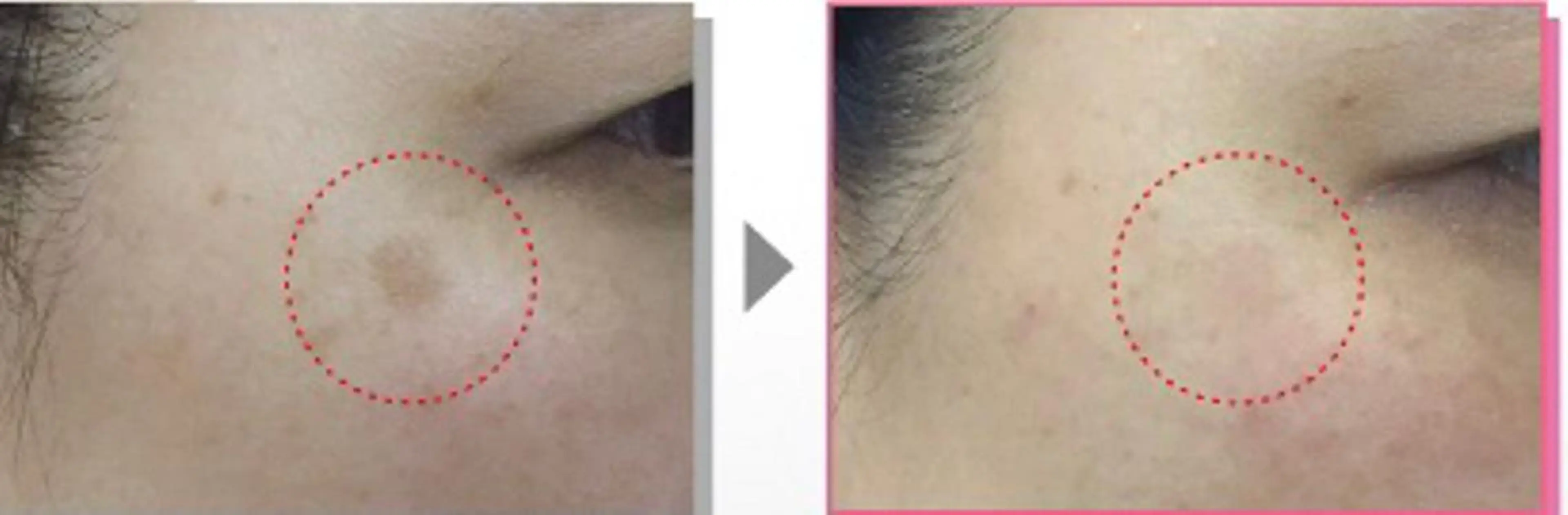 BestBelleꕤ 大阪福島/肌質改善のエステ・リラクイメージ