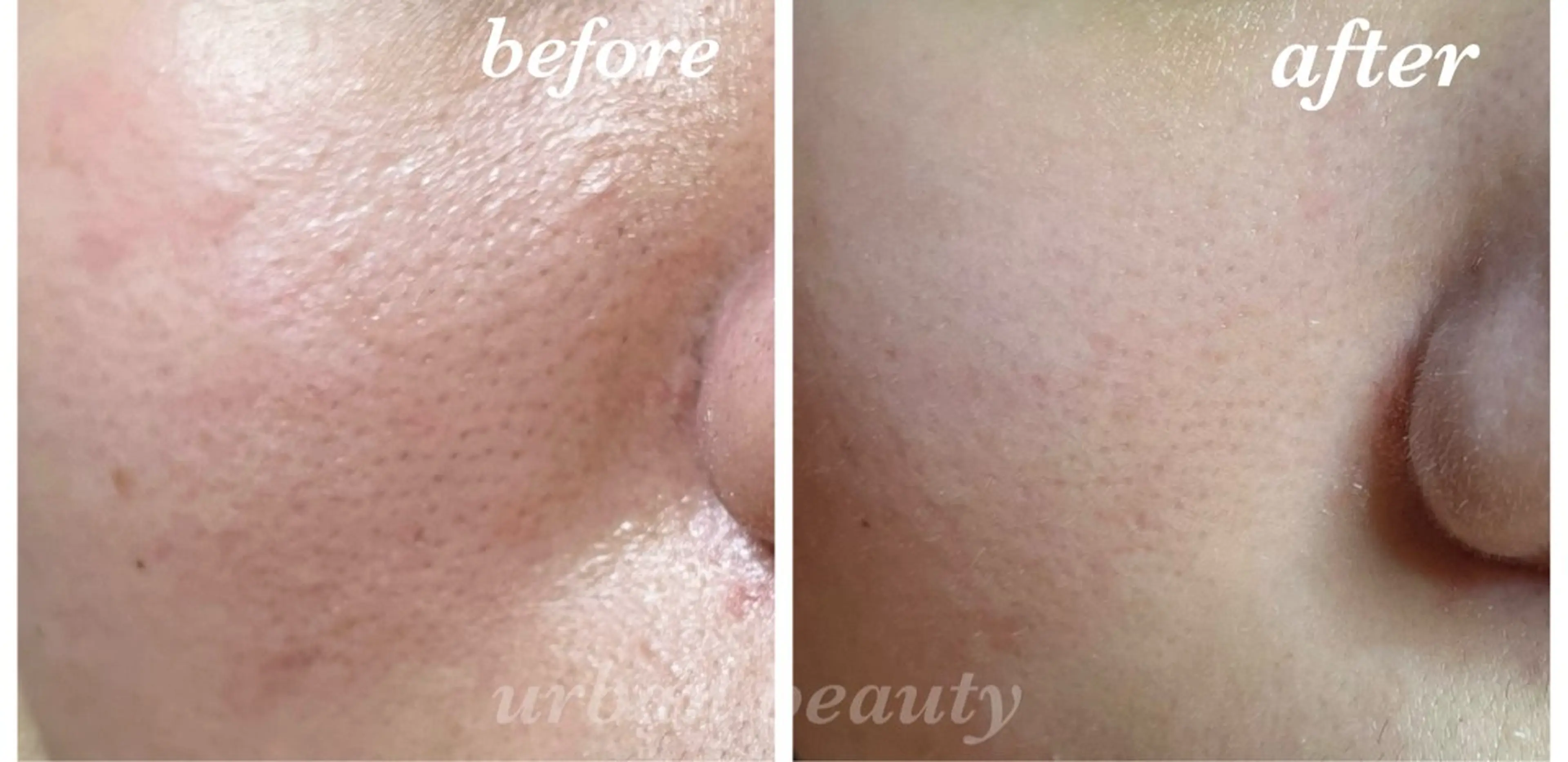 結果重視｜毛穴エステ ｜友綱理恵のエステ・リラクイメージ