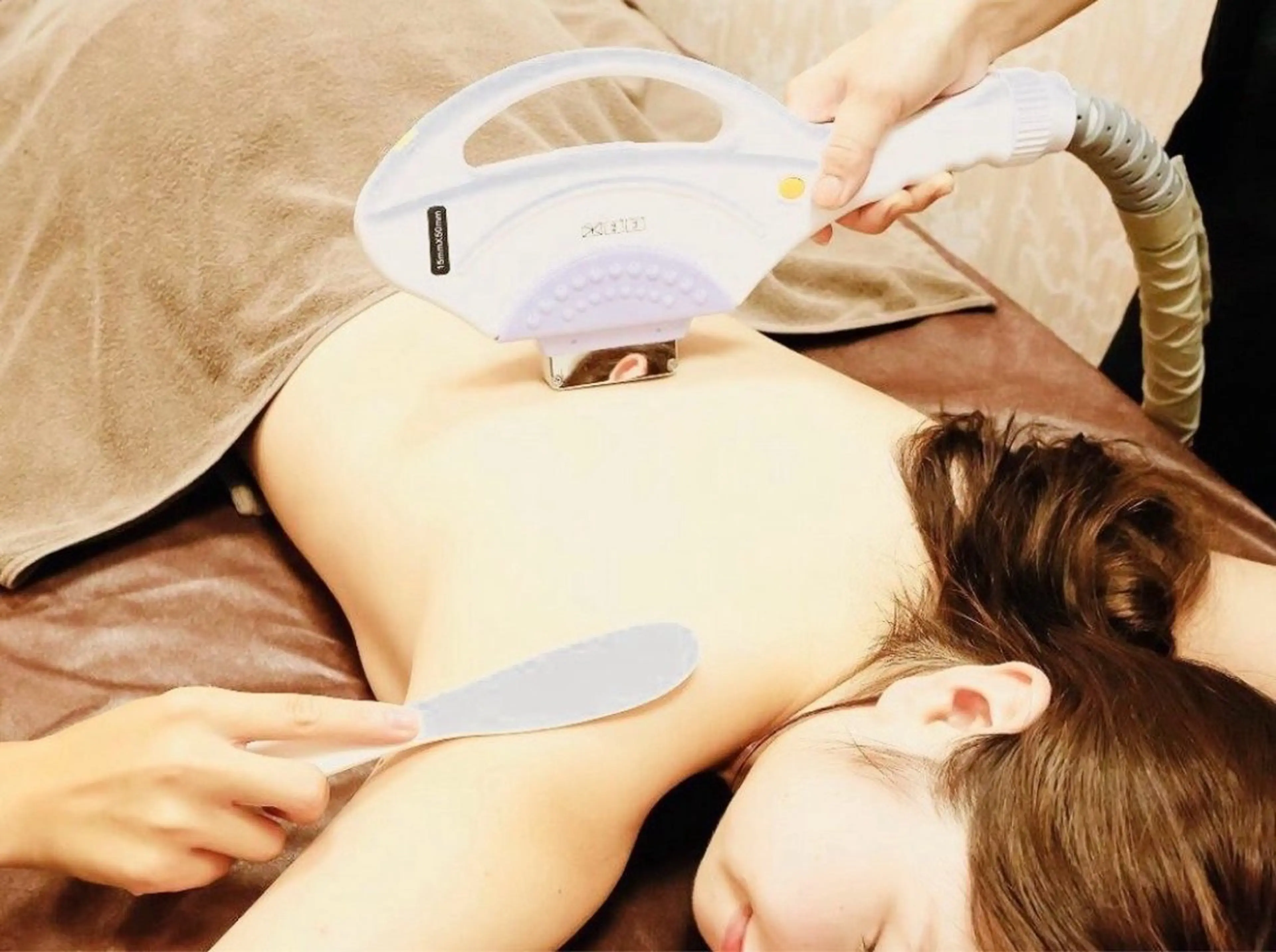 背中脱毛✨の写真