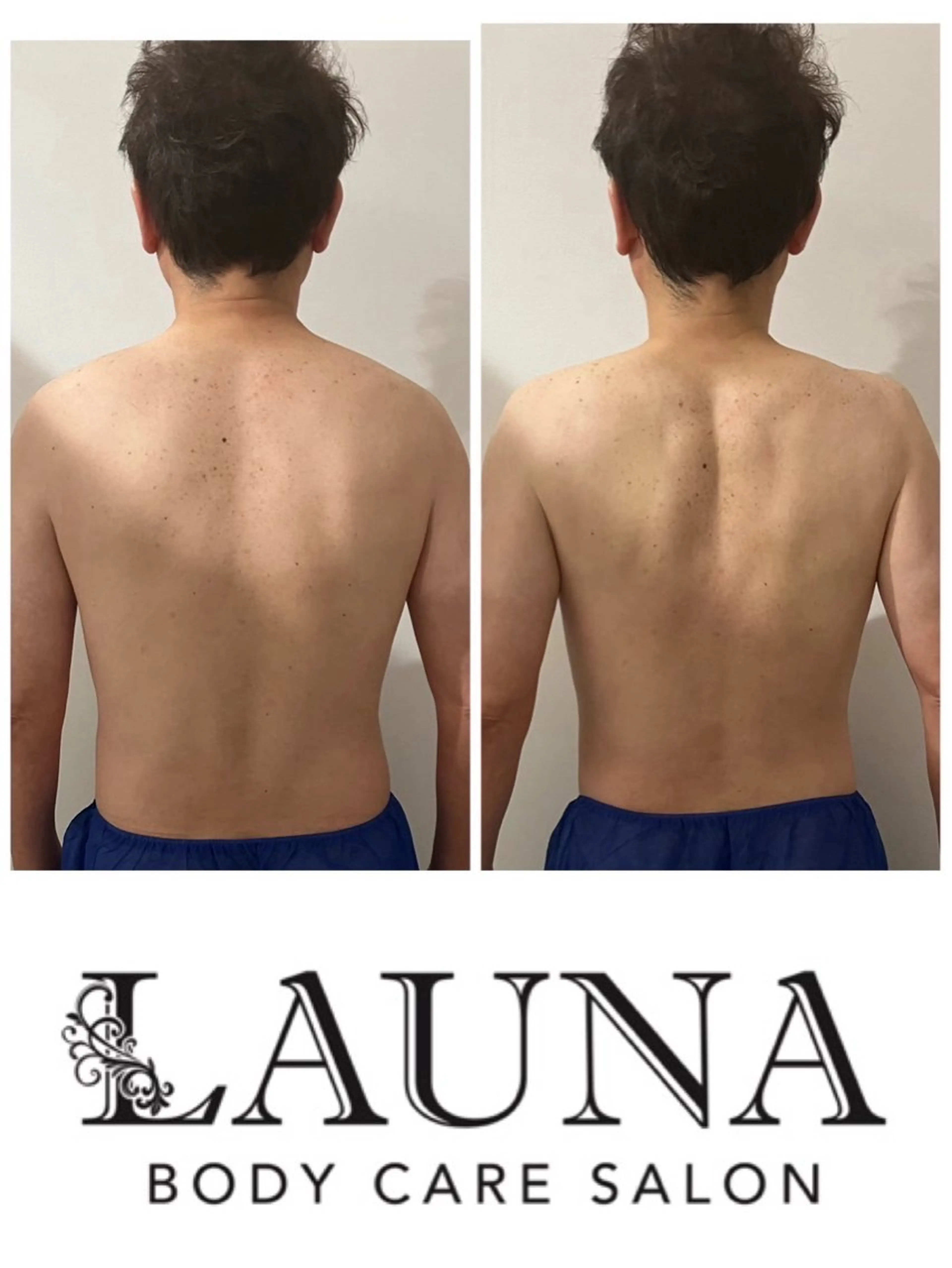 筋膜リリースカッター60分+よもぎ蒸し40分の写真