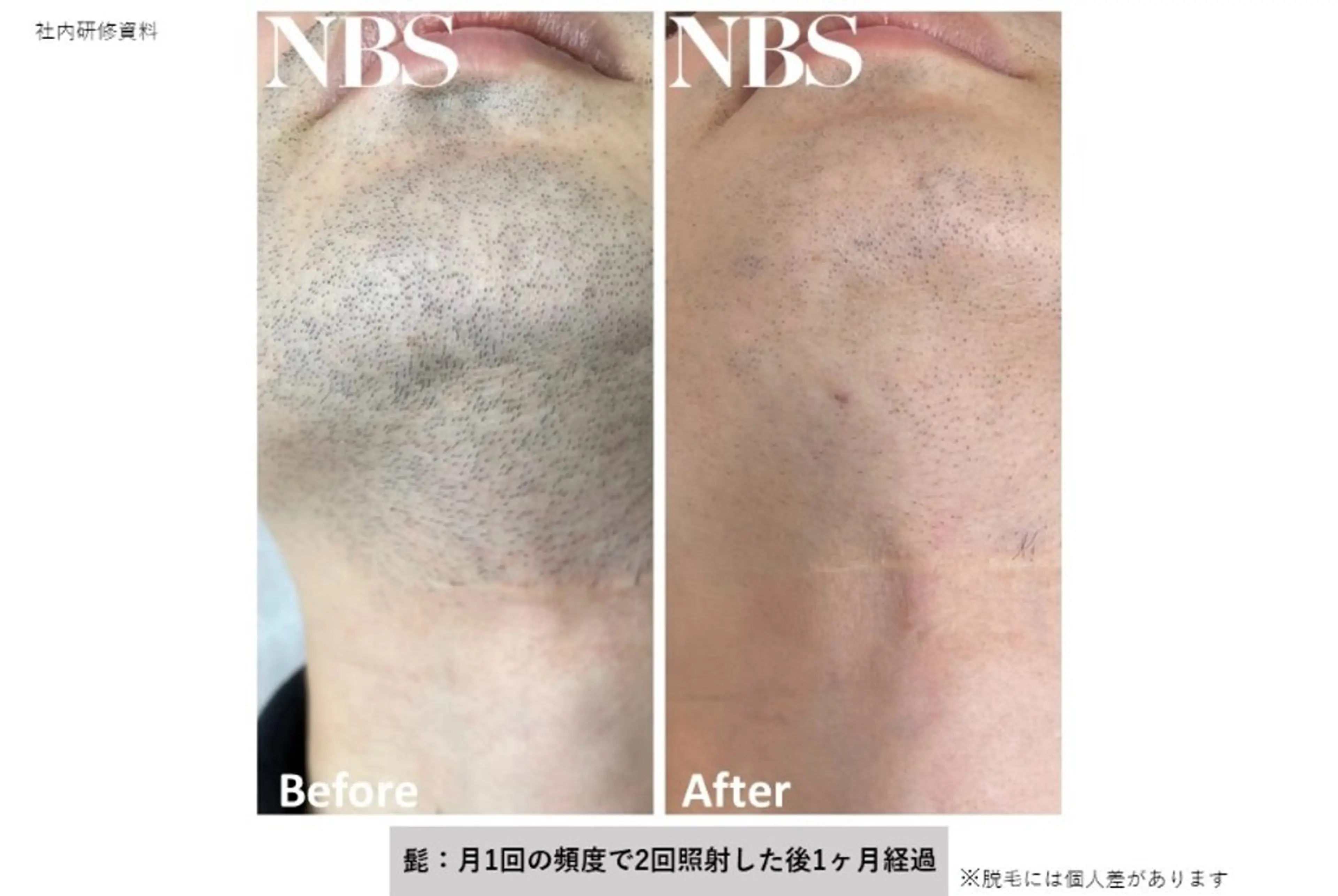 VIERU YURIのネイルデザイン