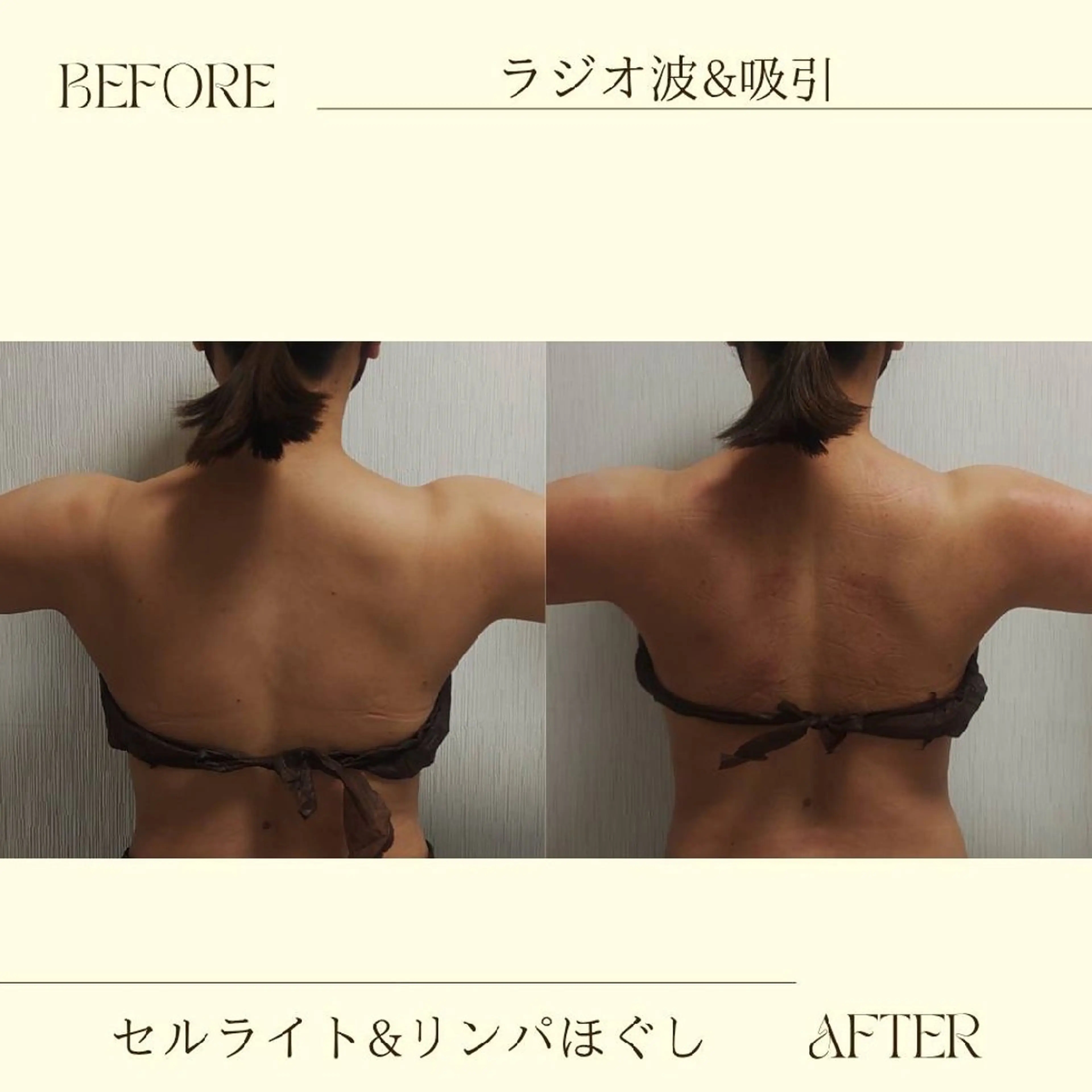 痩身小顔専門 アマテ ビューティー.Nのエステ・リラクイメージ