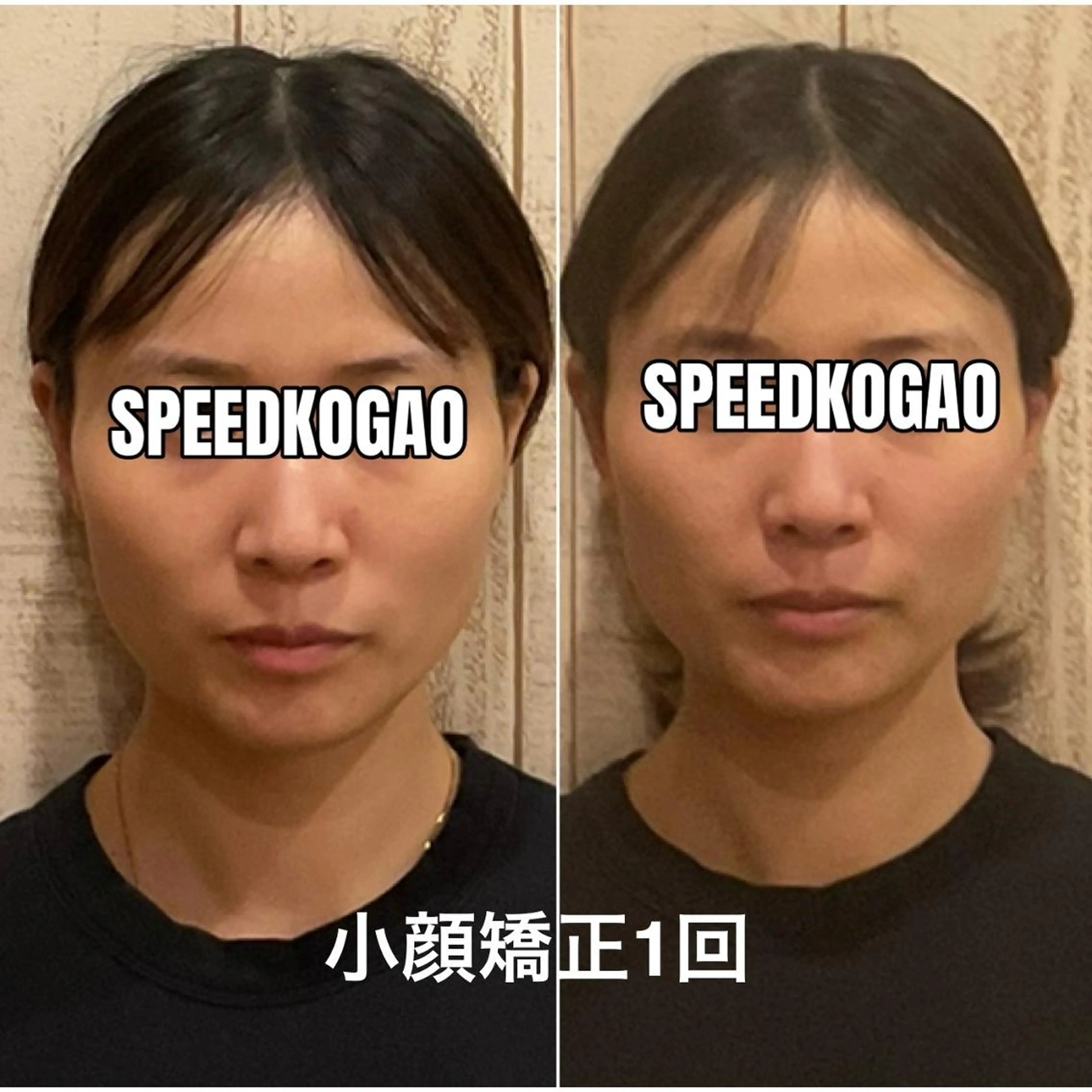 エステ リラク 小顔矯正Speed KOGAO渋谷本店のエステ・リラクイメージ