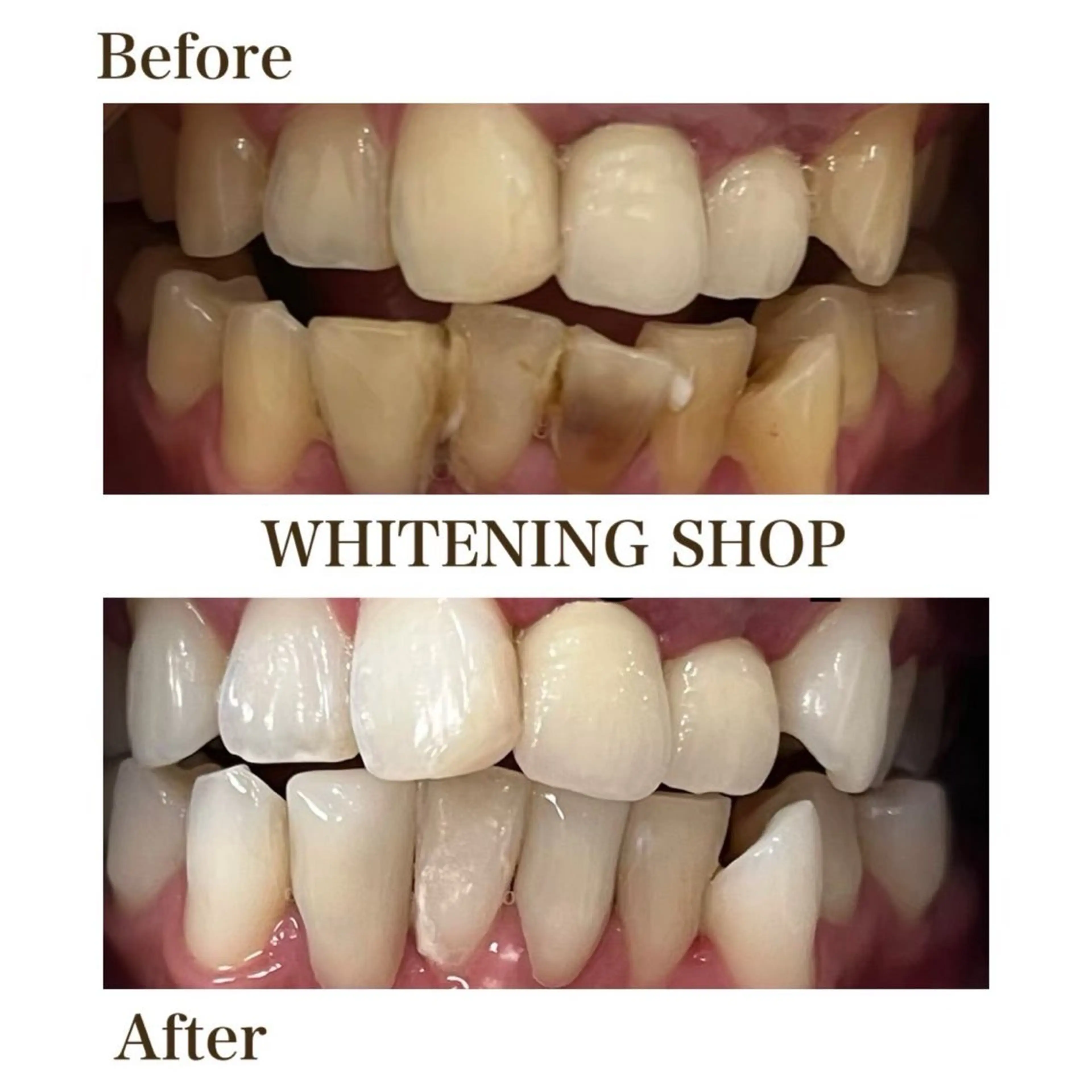 メンズ ホワイトニング ショップ葵区静岡駅店のその他イメージ