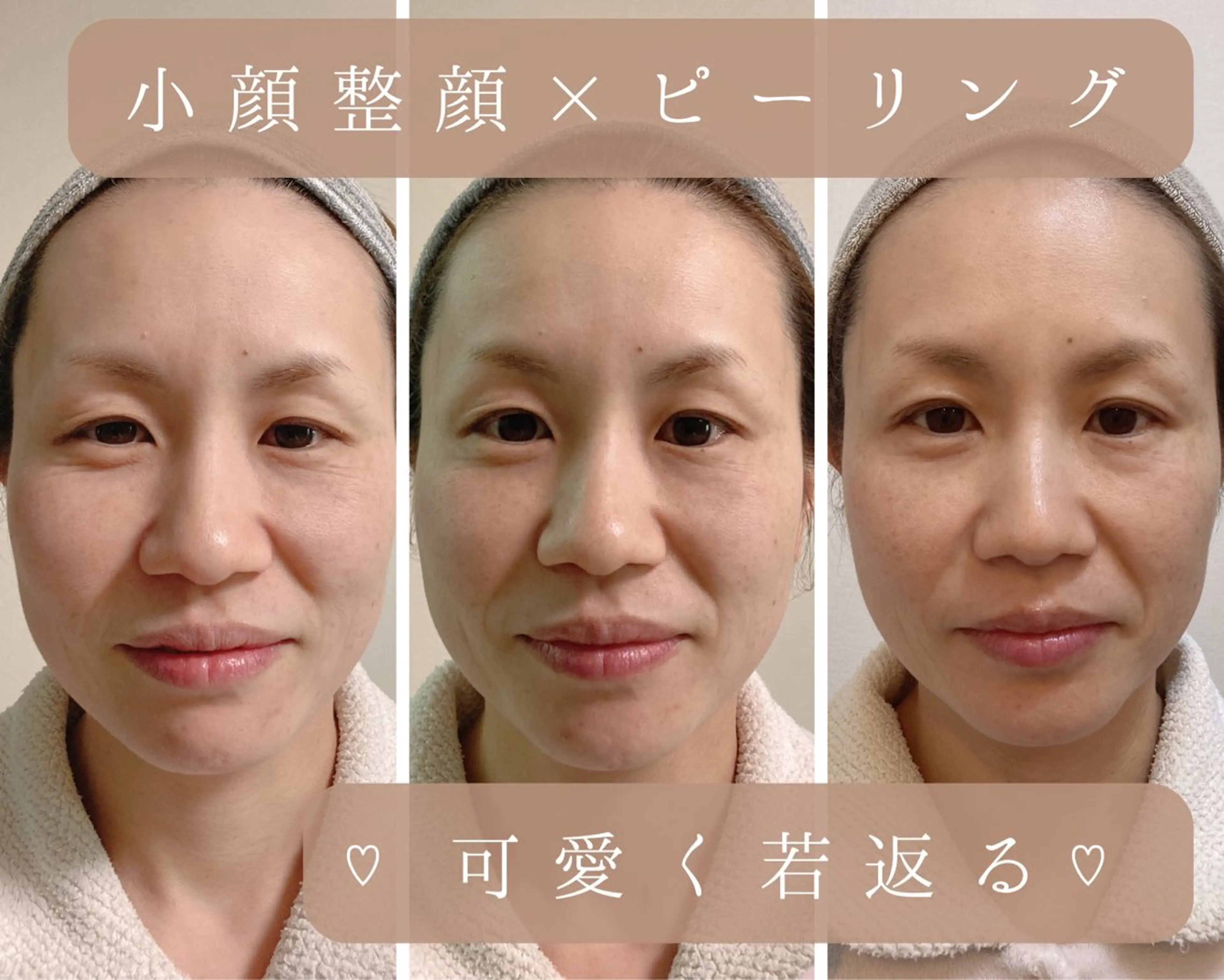 エステ リラク 小顔×肌質改善サロン soin〔ソワン〕のエステ・リラクイメージ