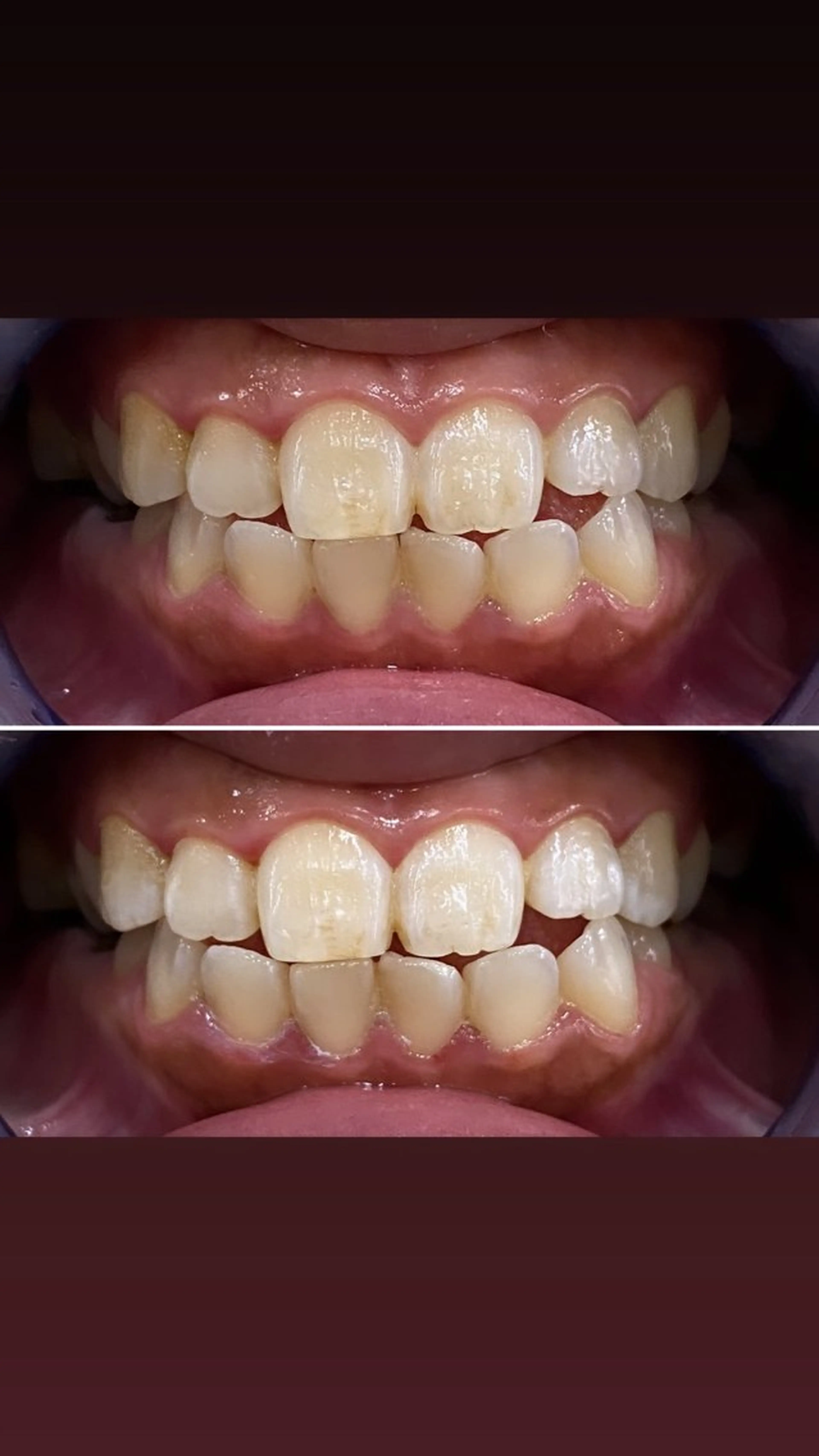 その他 whiteclub THREEのその他イメージ