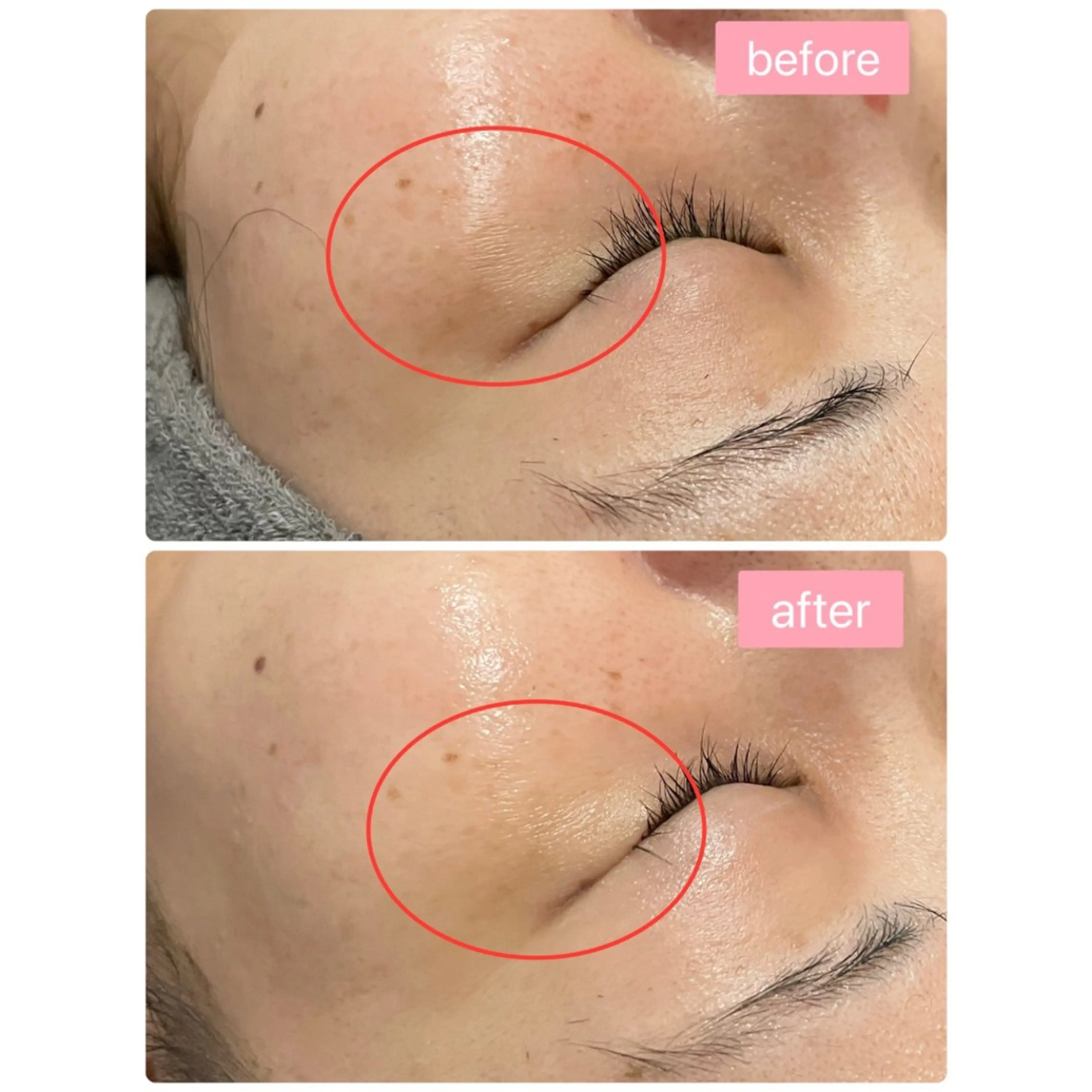 Monart -deux-のエステ・リラクイメージ