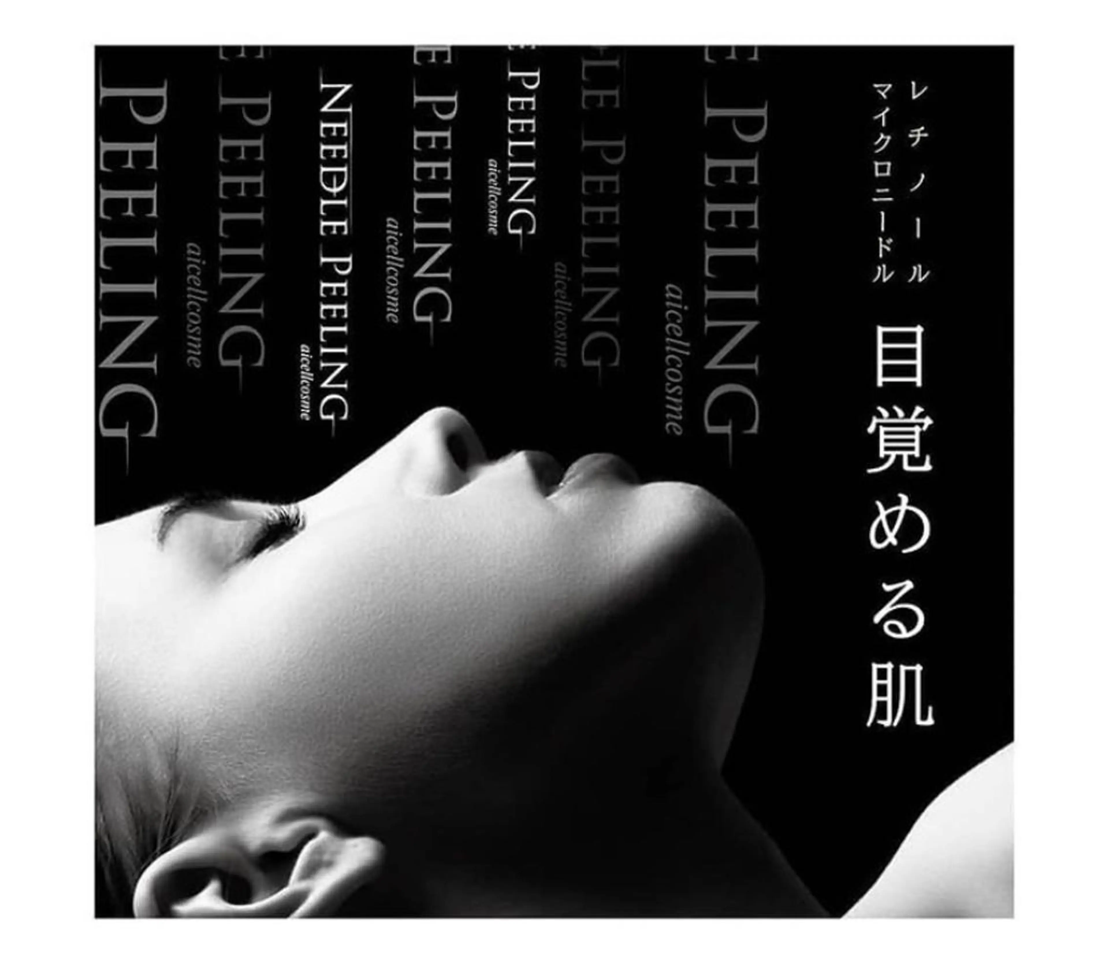 ニードルピーリング✨モニター価格✨ニキビにお悩みの方にダウタイムなしのニードルで肌再生を促しますの写真