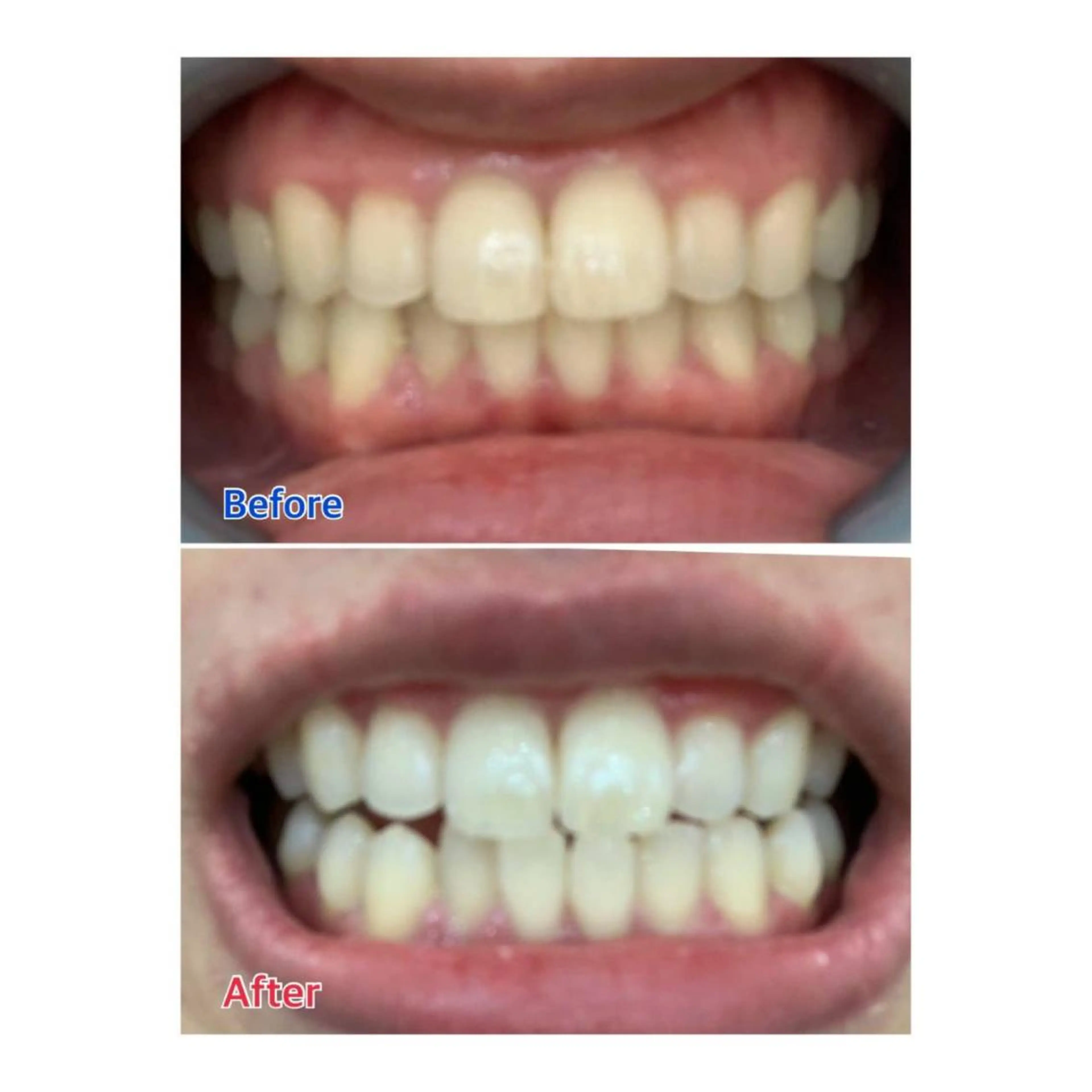 MBEAUTYSALON 千葉店・京成大久保所属・Melty 輝のその他イメージ