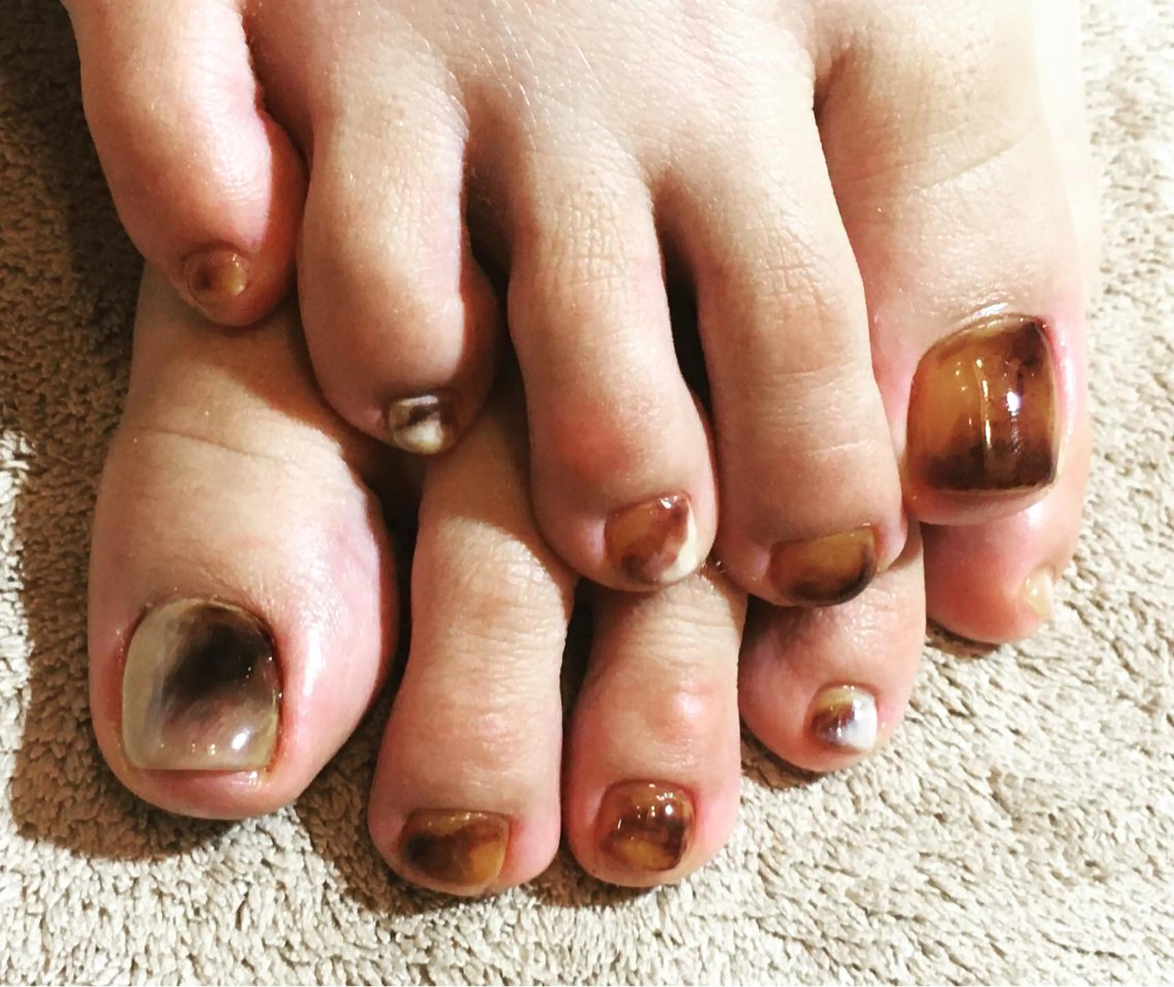 ネイル 古川 里美のネイルデザイン