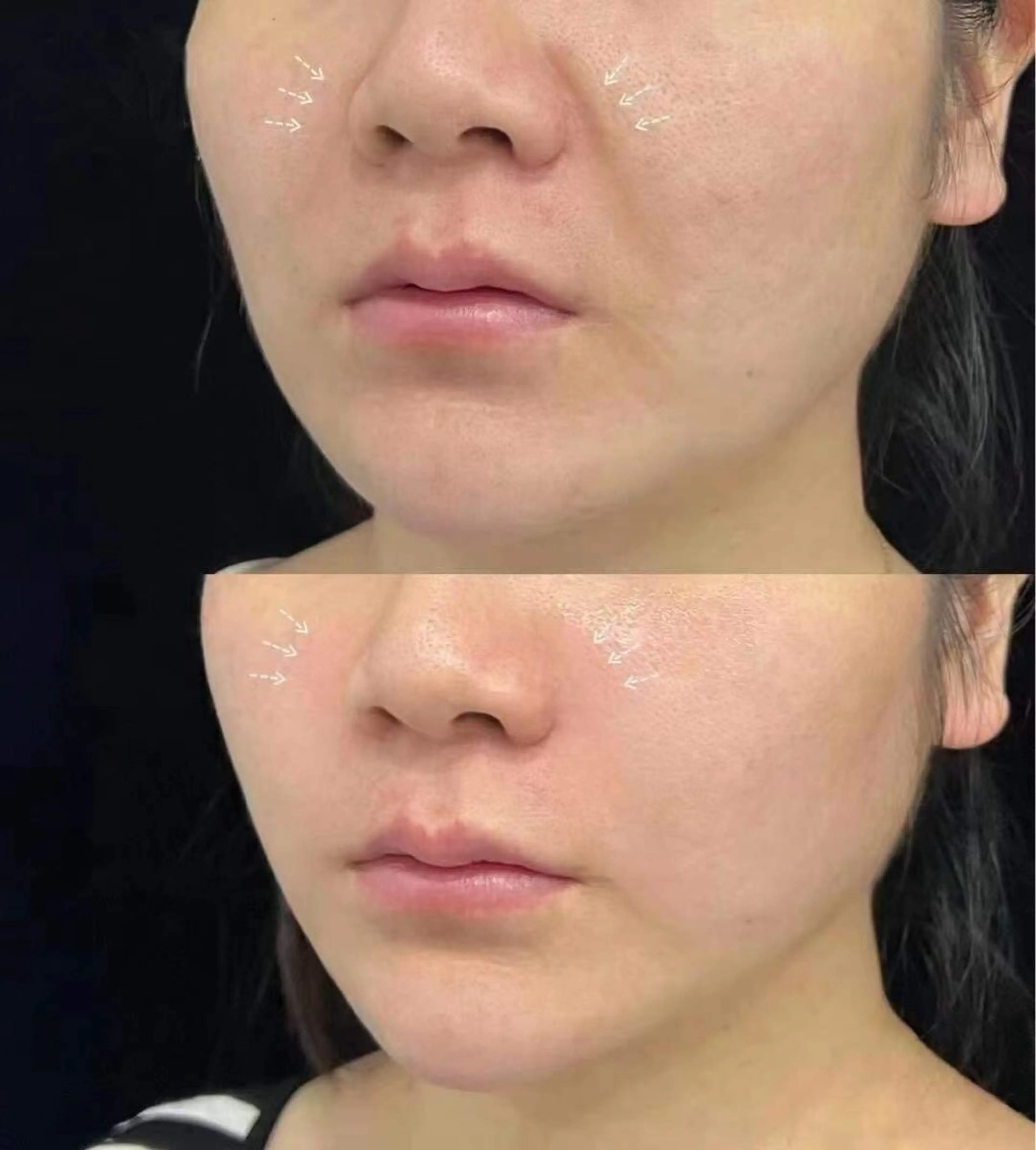 ネイル エステ aliaハーブ水光店 エステティシャン募集のエステ・リラクイメージ