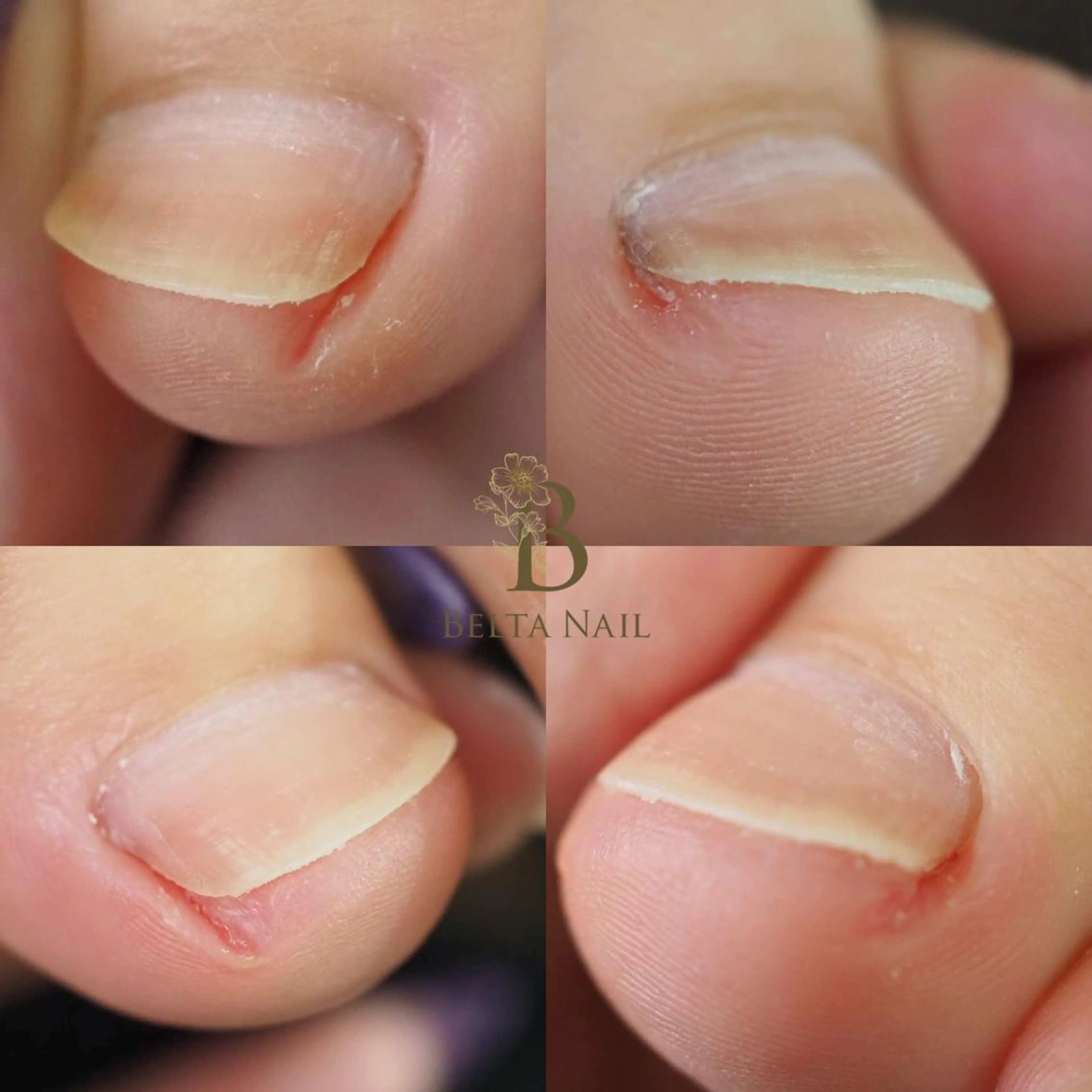 ネイル フットネイル BELTA NAILのネイルデザイン