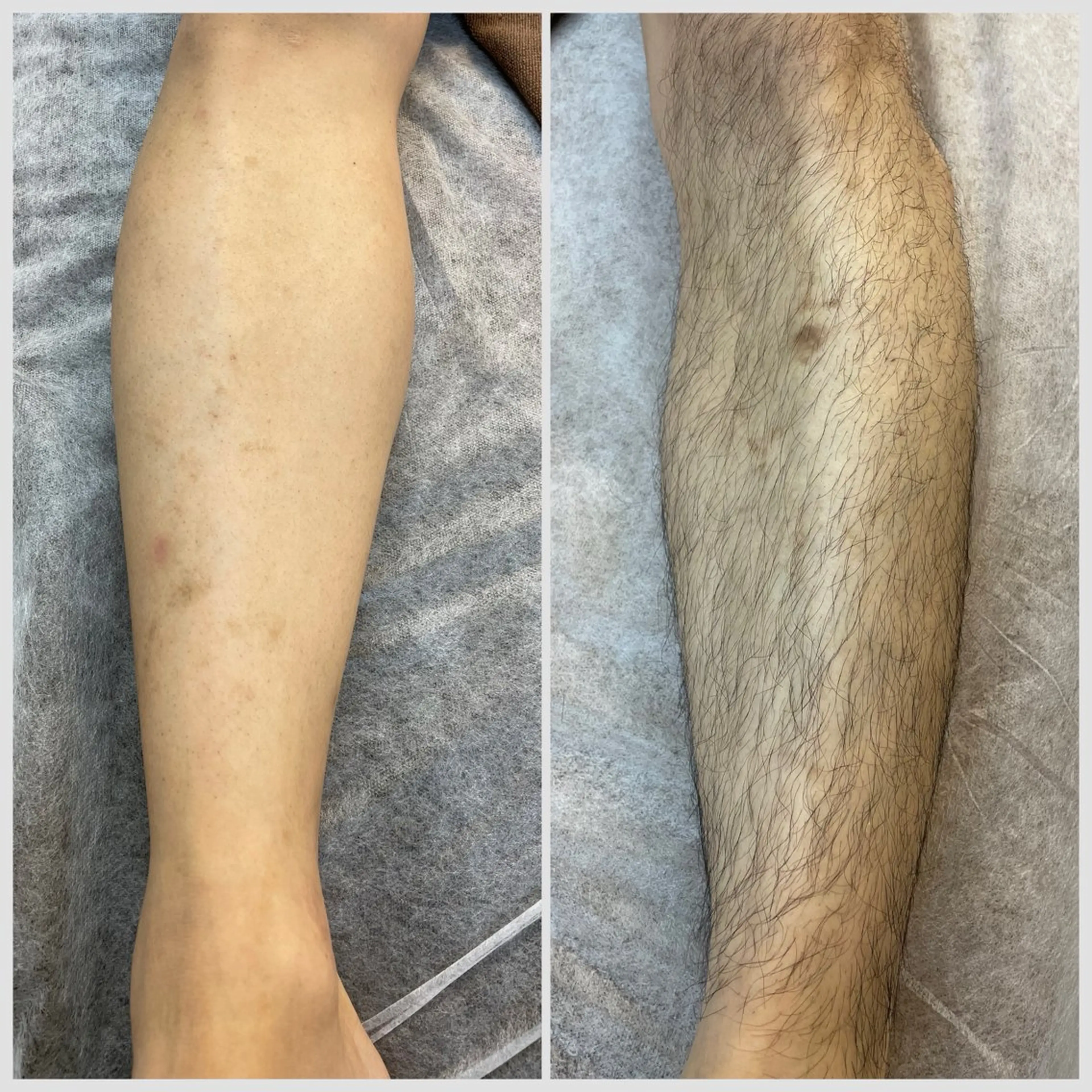 メンズ メンズ脱毛 ビーグラッド神戸三宮のエステ・リラクイメージ