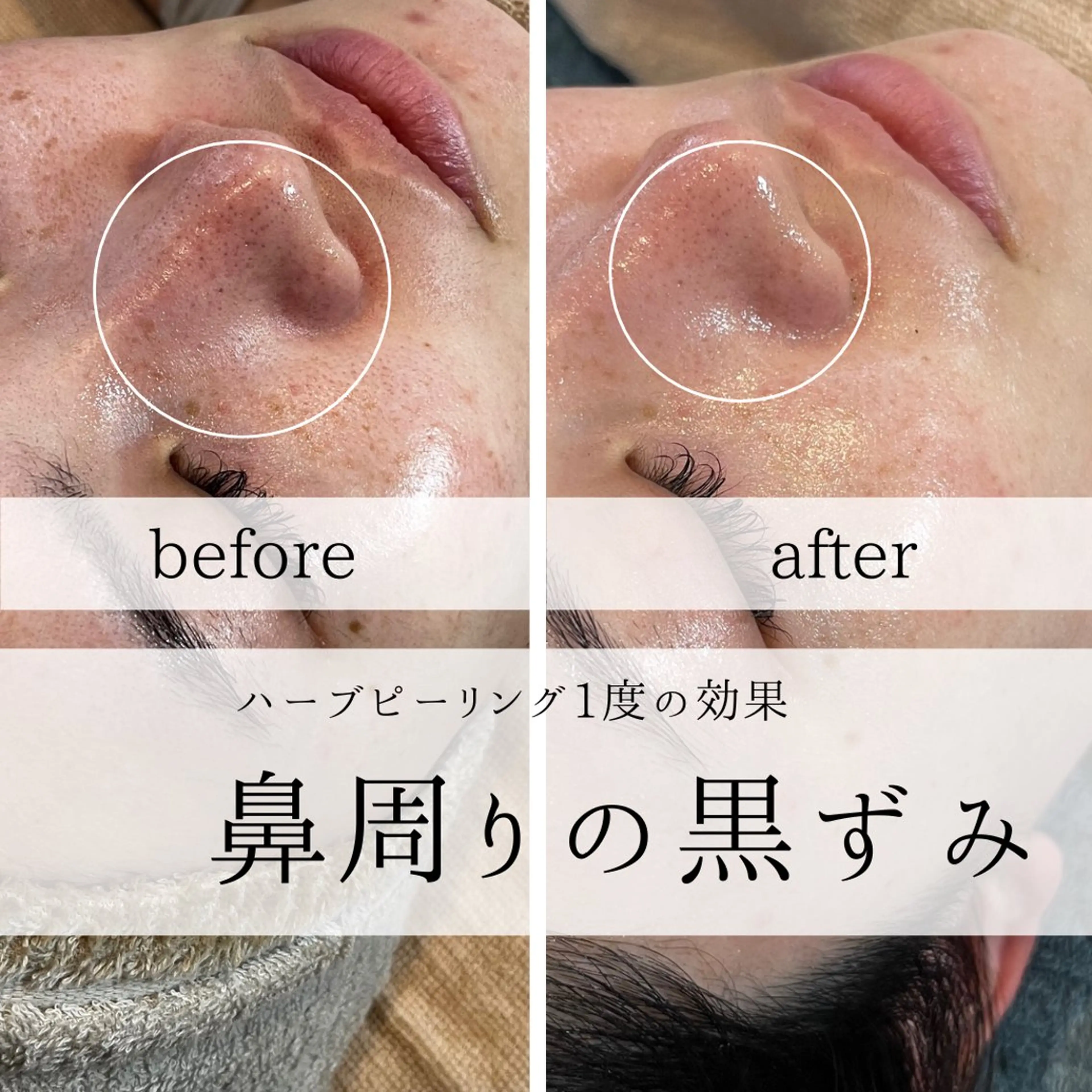 yc.hacci 【ハーブピーリング】の眉毛・アイブロウイメージ