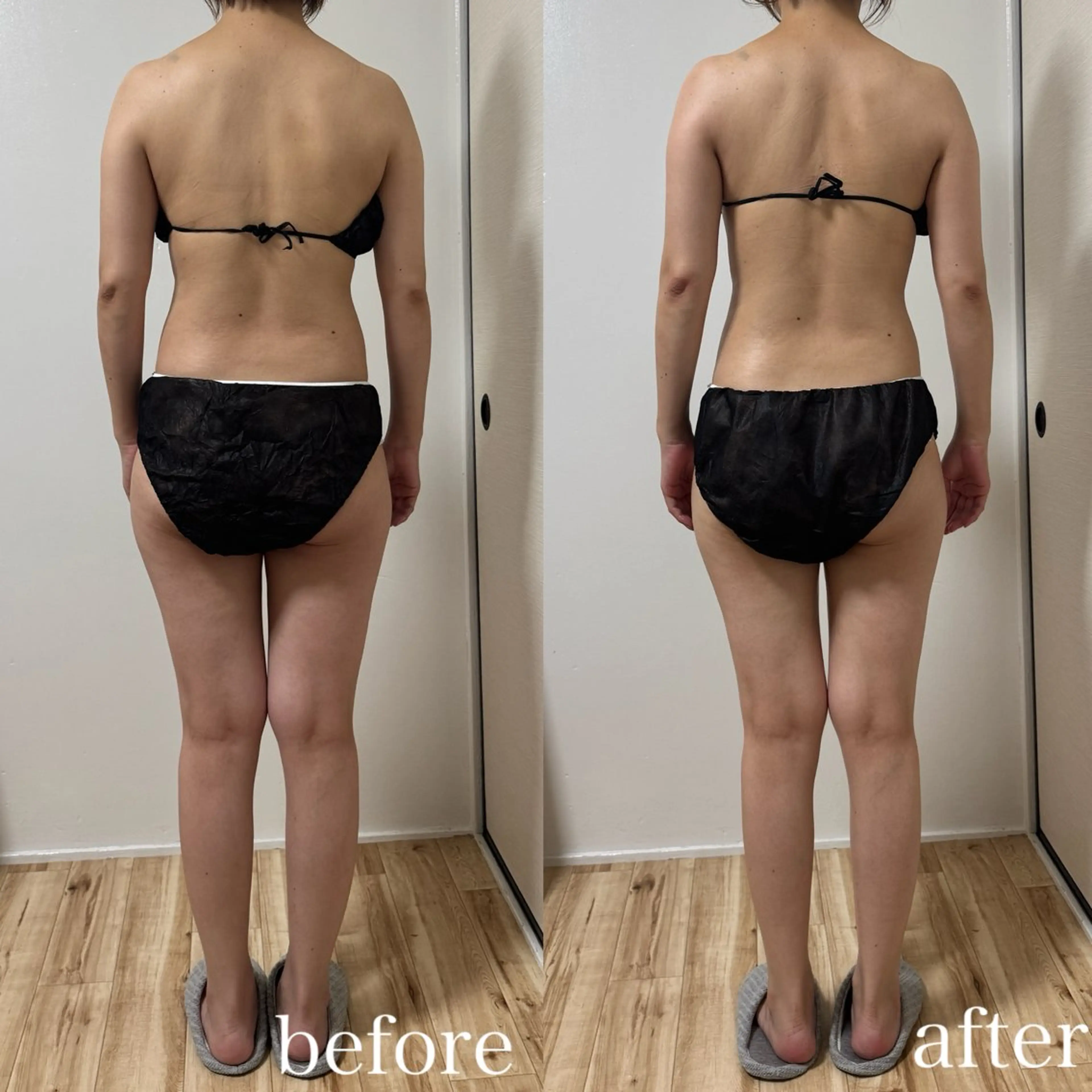 ご新規様限定¥3000オフ！全身筋膜リリース×リンパケア  100分の写真